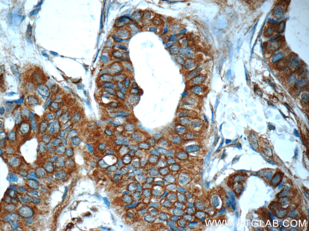 Mammaglobin A Polyclonal antibody