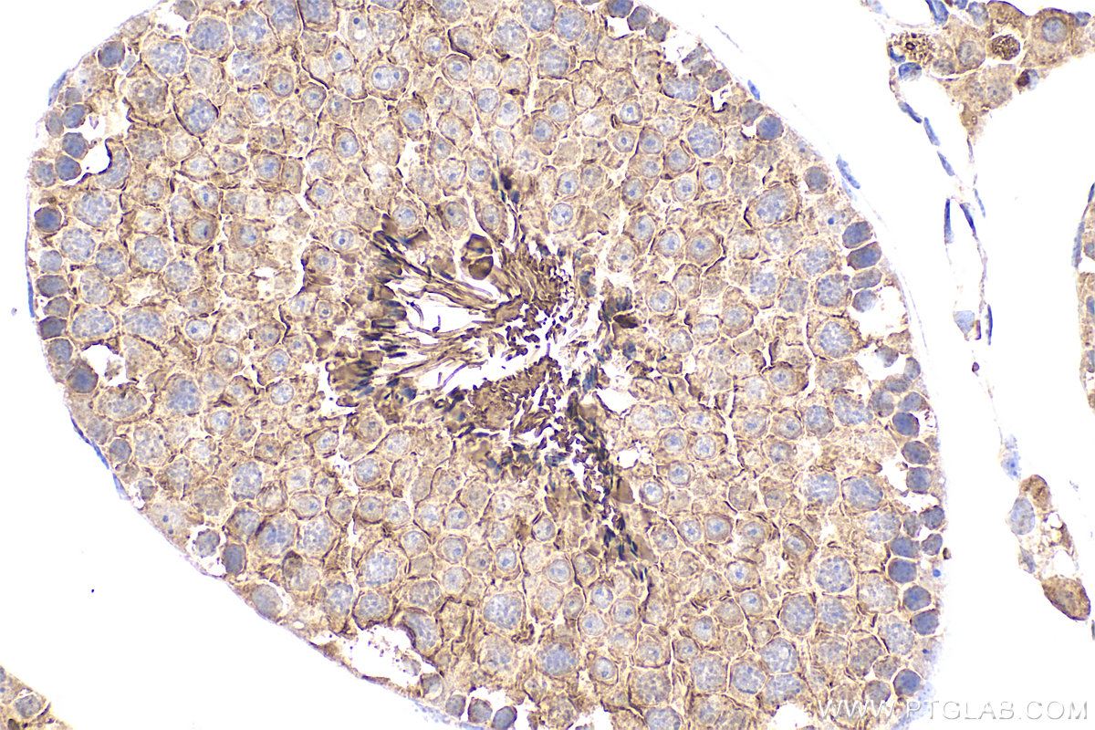 IHC staining of mouse testis using 25560-1-AP