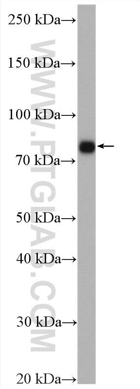 WB analysis of mouse brain using 10004-2-Ig