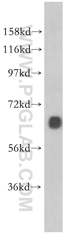 WB analysis of mouse brain using 10002-2-AP