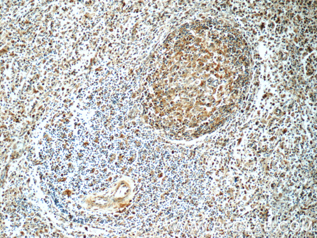 IHC staining of human spleen using 15825-1-AP