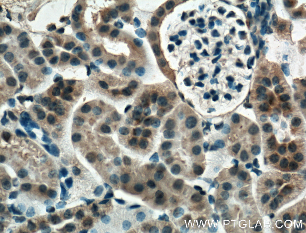 Mcp1 Monoclonal antibody