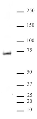 MeCP2 phospho Ser80 antibody (pAb) tested by Western blot. Detection of MeCP2 phospho Ser80 by Western blot analysis. Rat brain extract (20 ug) probed with MeCP2 phospho Ser80 antibody (pAb) at a 1:5,000 dilution. MeCP2 phospho Ser80 antibody (pAb) tested by Western blot. Detection of MeCP2 phospho Ser80 by Western blot analysis. Rat brain extract (20 ug) probed with MeCP2 phospho Ser80 antibody (pAb) at a 1:5,000 dilution.