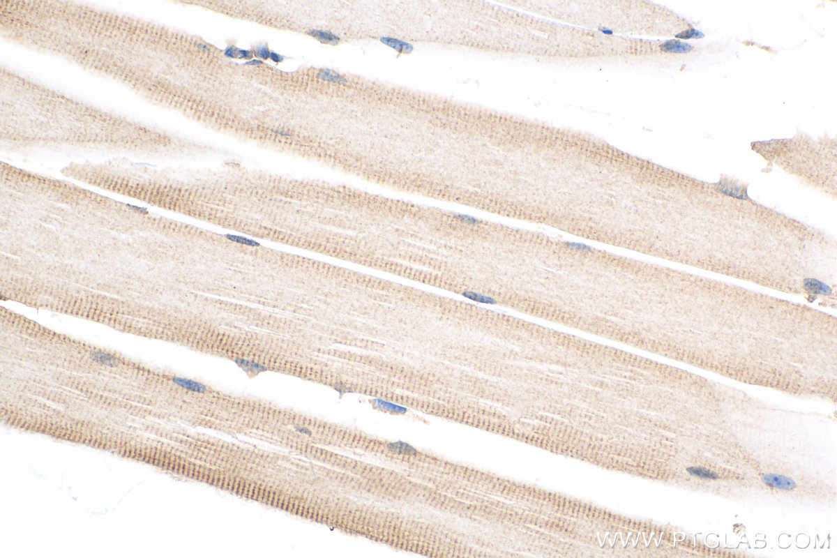 IHC staining of mouse skeletal muscle using 51025-2-Ig (same clone as 51025-2-PBS)