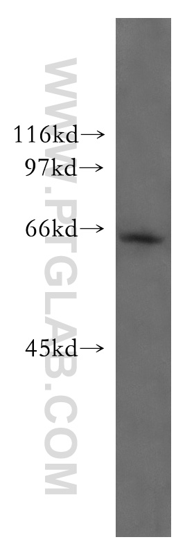 WB analysis of mouse skeletal muscle using 51025-2-Ig (same clone as 51025-2-PBS)