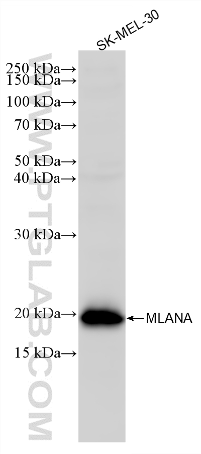 WB analysis of SK-MEL-30 using 87351-2-RR (same clone as 87351-2-PBS) WB analysis of SK-MEL-30 using 87351-2-RR (same clone as 87351-2-PBS)