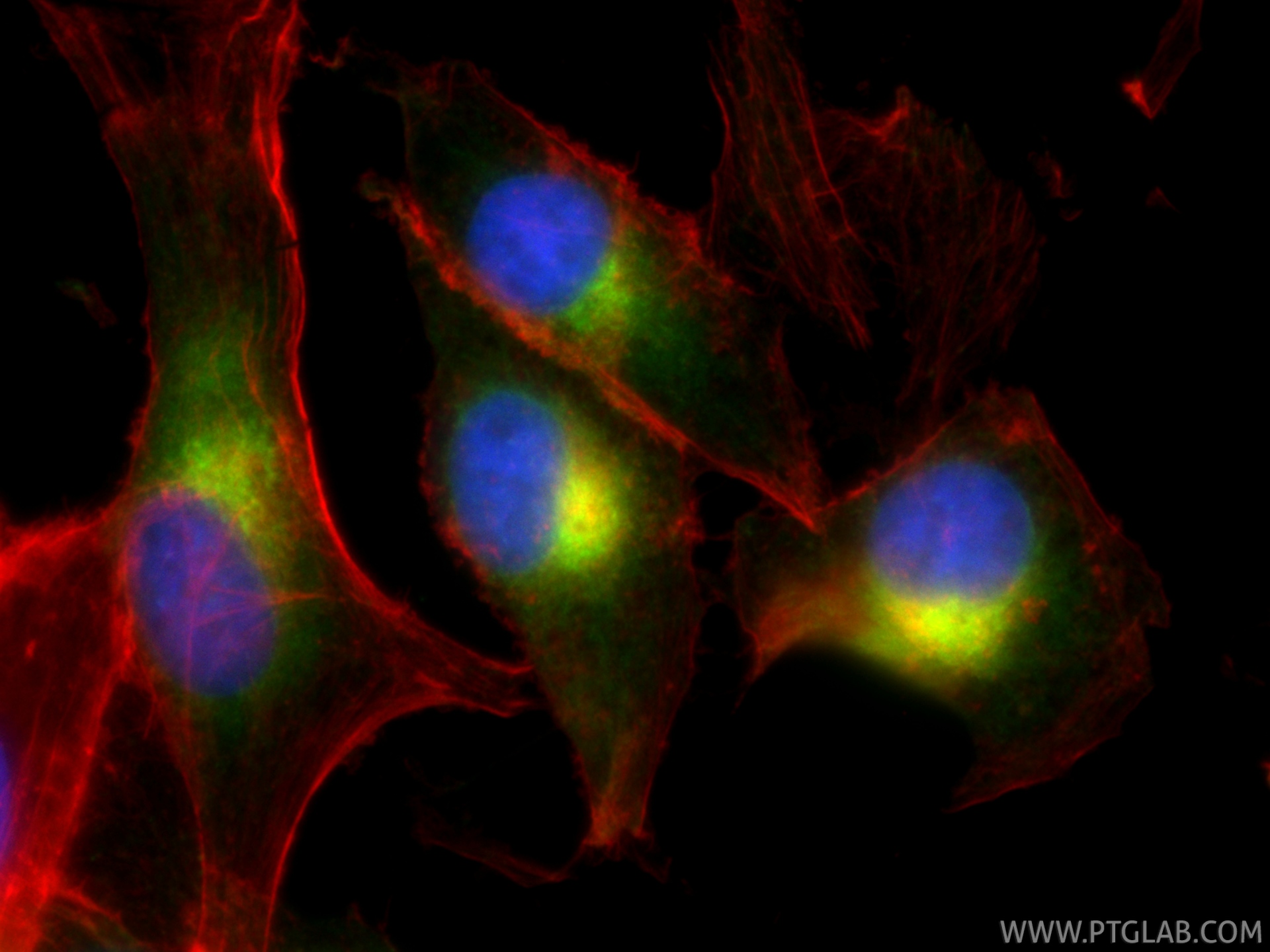 IF Staining of SK-MEL-28 using 87351-4-RR