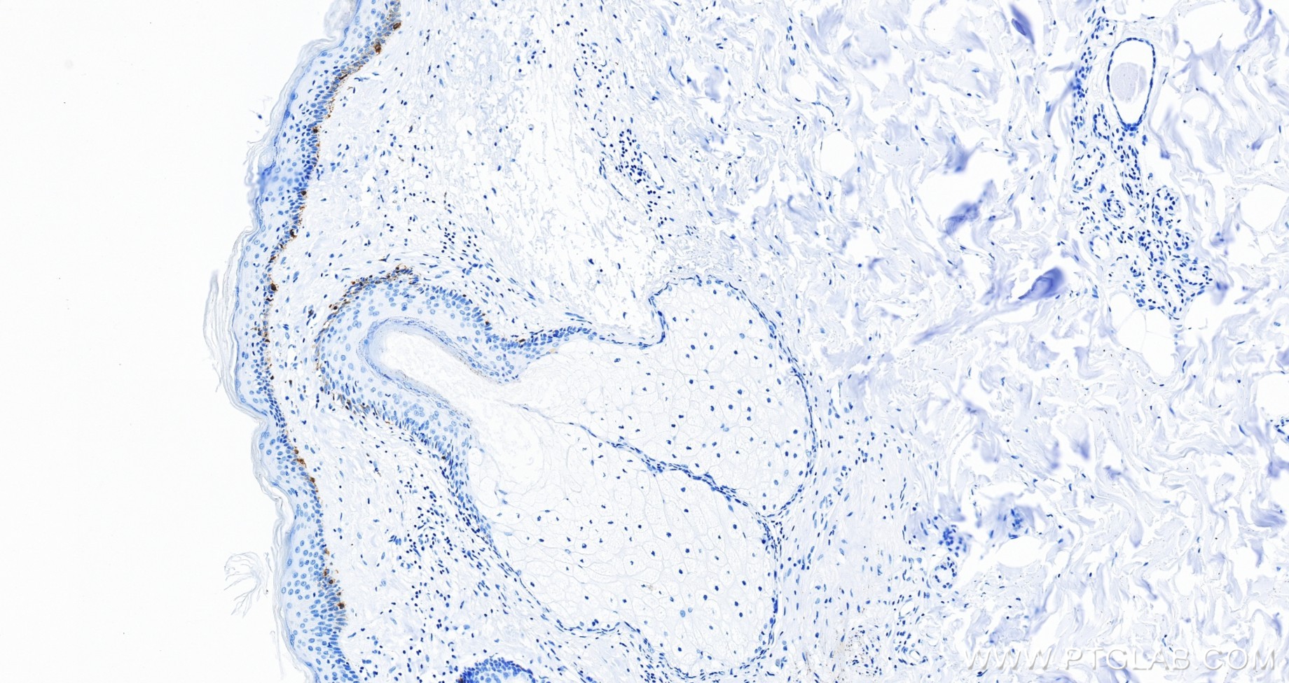 IHC staining of human skin using 87351-4-RR (same clone as 87351-4-PBS) IHC staining of human skin using 87351-4-RR (same clone as 87351-4-PBS)