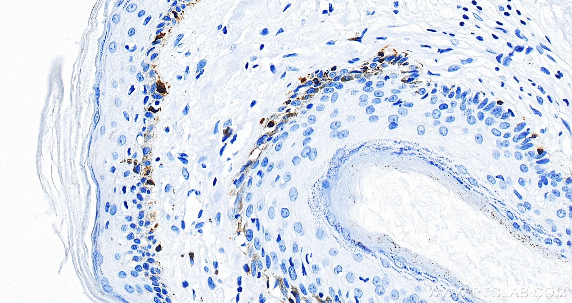 IHC staining of human skin using 87351-4-RR (same clone as 87351-4-PBS) IHC staining of human skin using 87351-4-RR (same clone as 87351-4-PBS)