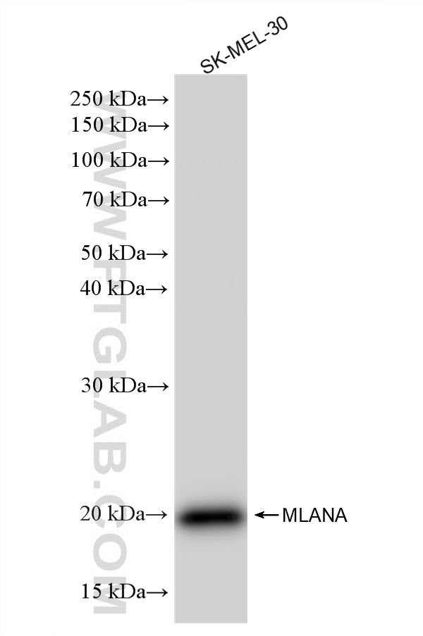 WB analysis of SK-MEL-30 using 87351-4-RR (same clone as 87351-4-PBS) WB analysis of SK-MEL-30 using 87351-4-RR (same clone as 87351-4-PBS)