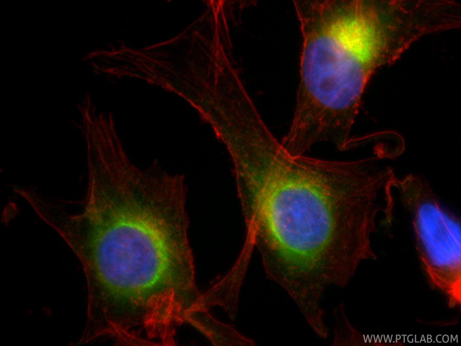IF Staining of SK-MEL-28 using CL488-87351-4 IF Staining of SK-MEL-28 using CL488-87351-4