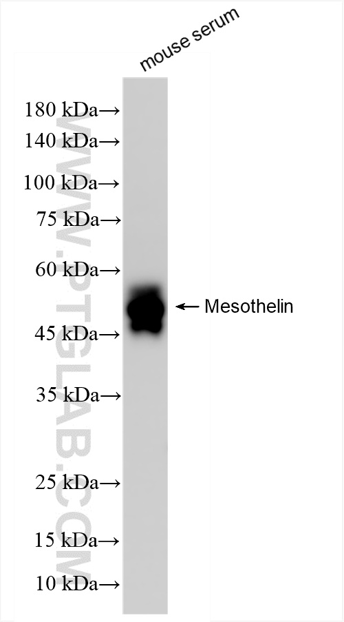 WB analysis of mouse serum using 85774-4-RR