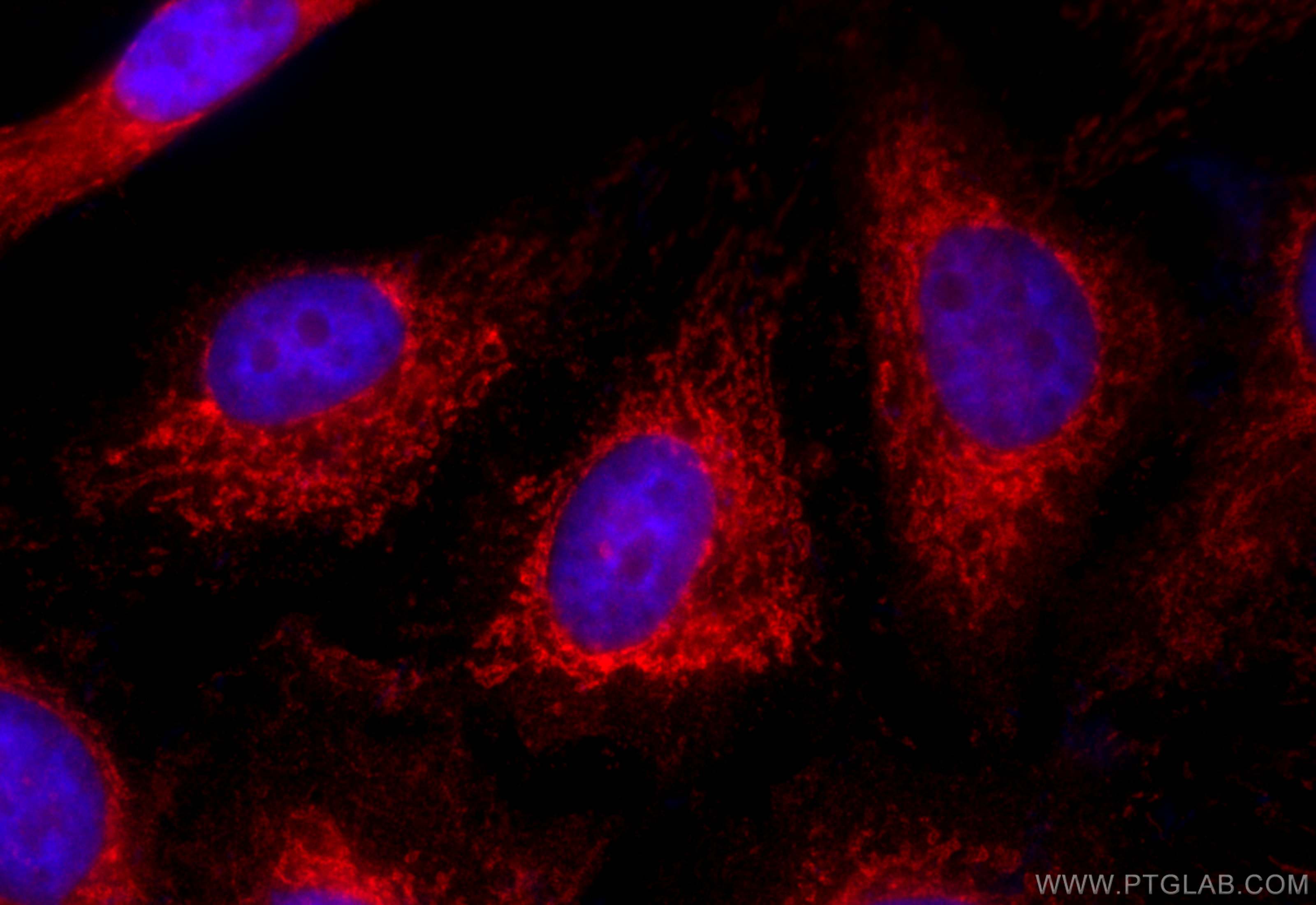 IF Staining of HeLa using CL594-10179