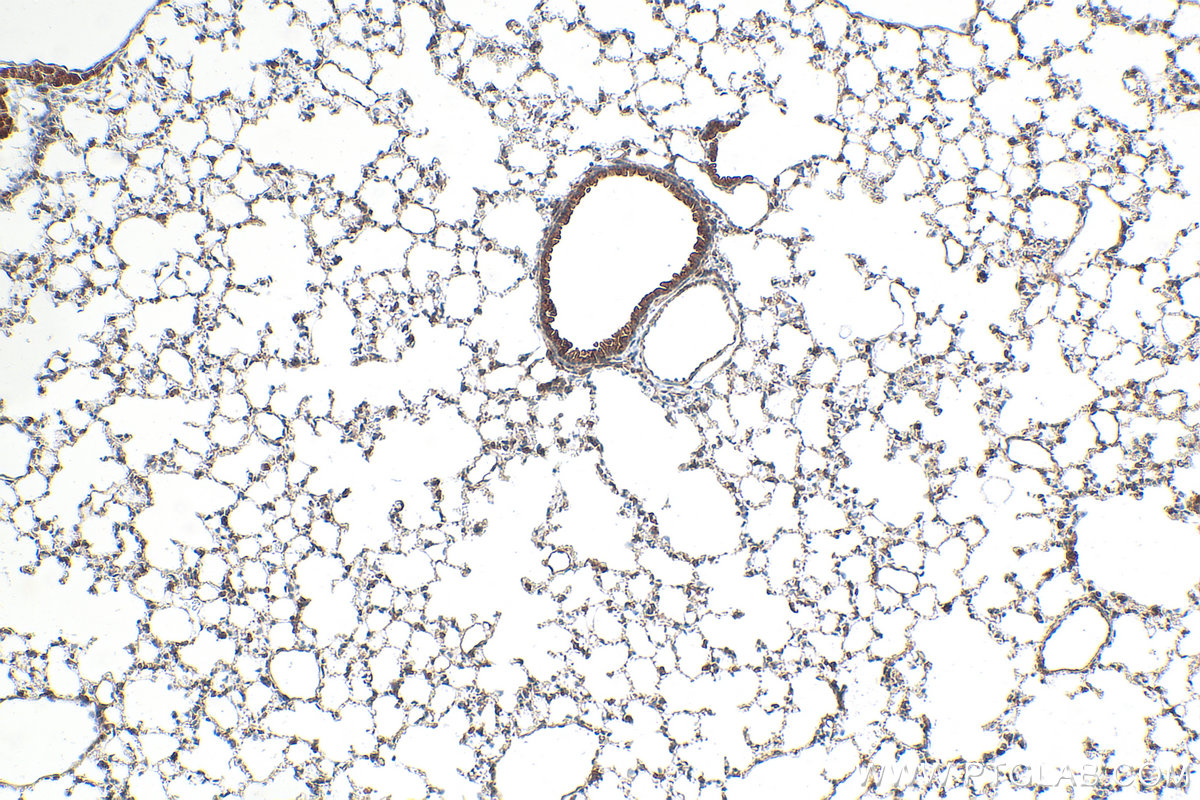 IHC staining of mouse lung using 30145-1-AP IHC staining of mouse lung using 30145-1-AP