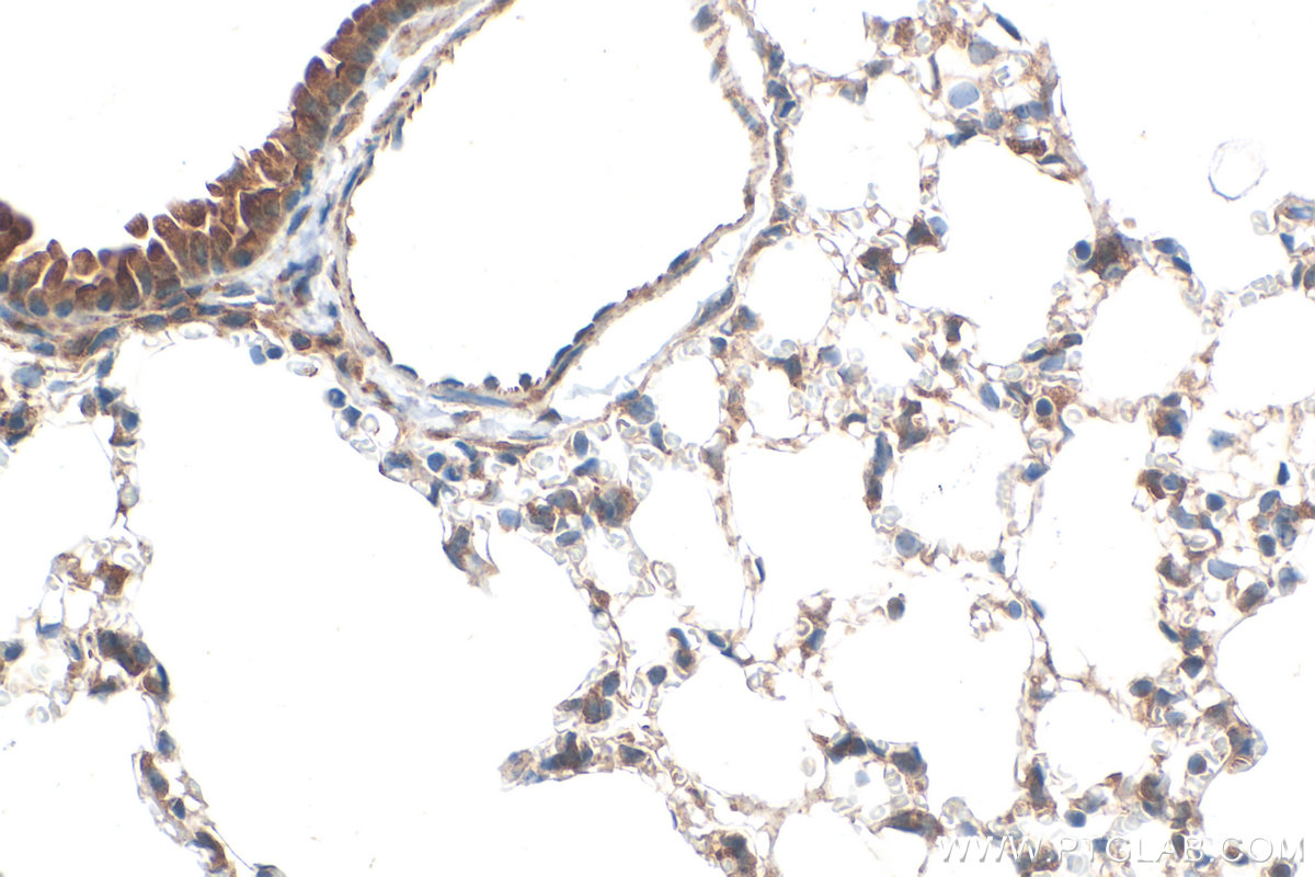 IHC staining of mouse lung using 30145-1-AP IHC staining of mouse lung using 30145-1-AP