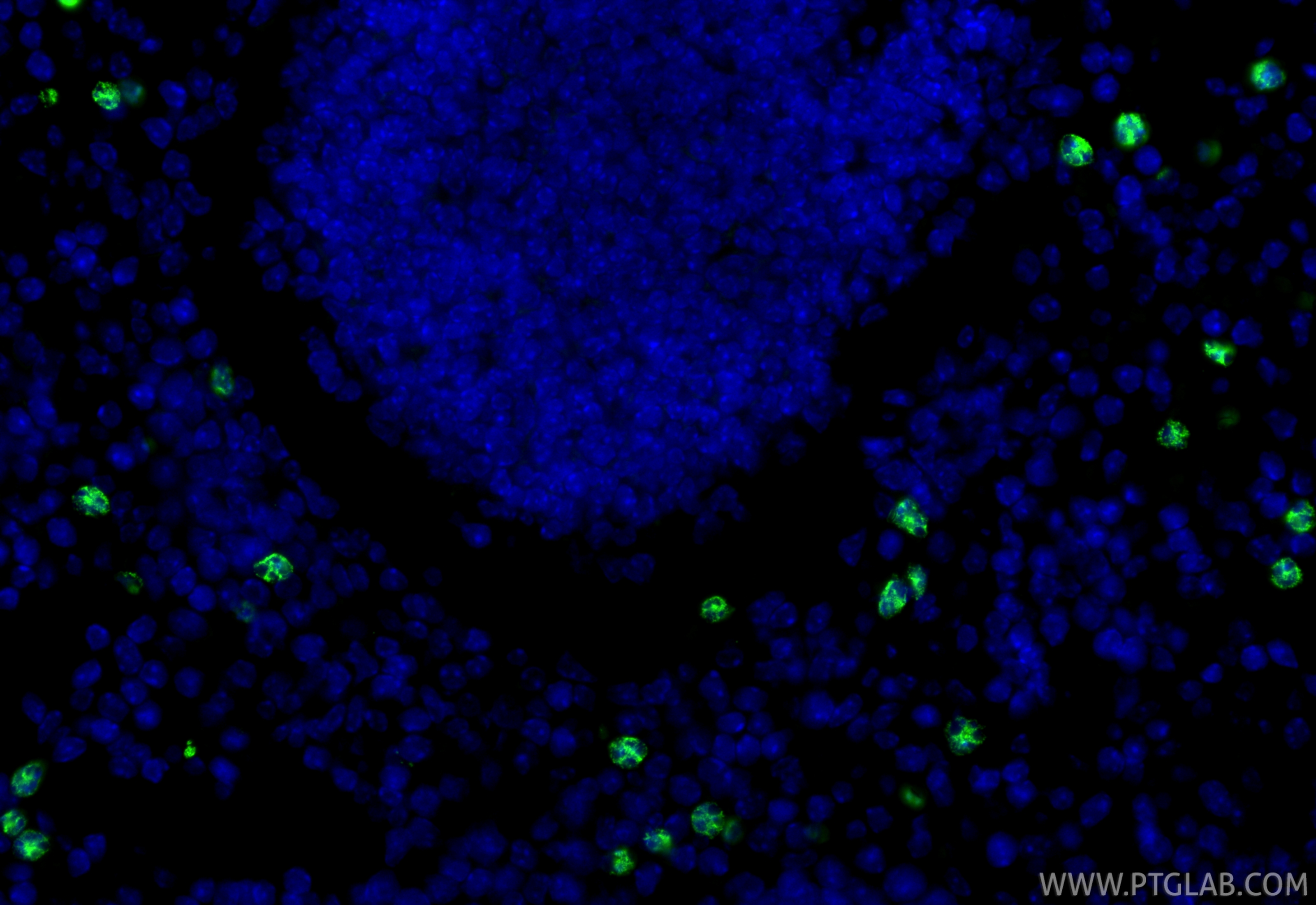 Immunofluorescent analysis of (4% PFA) fixed paraffin-embedded mouse spleen tissue using Mmp8 antibody (33084-1-AP) at dilution of 1:200 and CoraLite®488-Conjugated Goat Anti-Rabbit IgG(H+L) (<a class='green' href='/productredirect?CatalogNo=SA00013-2' target='_blank'>SA00013-2</a>). Heat mediated antigen retrieval with Tris-EDTA buffer (pH 9.0). IF Staining of mouse spleen using 33084-1-AP
