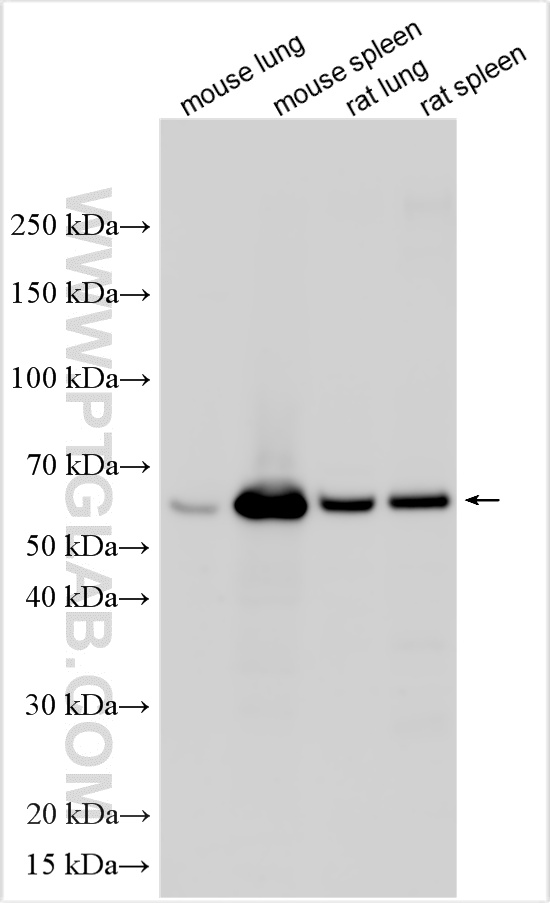 Various lysates were subjected to SDS PAGE followed by western blot with 33084-1-AP (Mmp8 antibody) at dilution of 1:1000 incubated at room temperature for 1.5 hours. WB analysis using 33084-1-AP