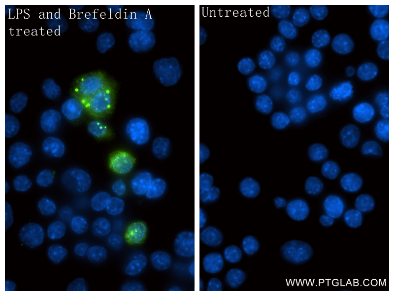 IF Staining of RAW 264.7 using 82854-8-RR