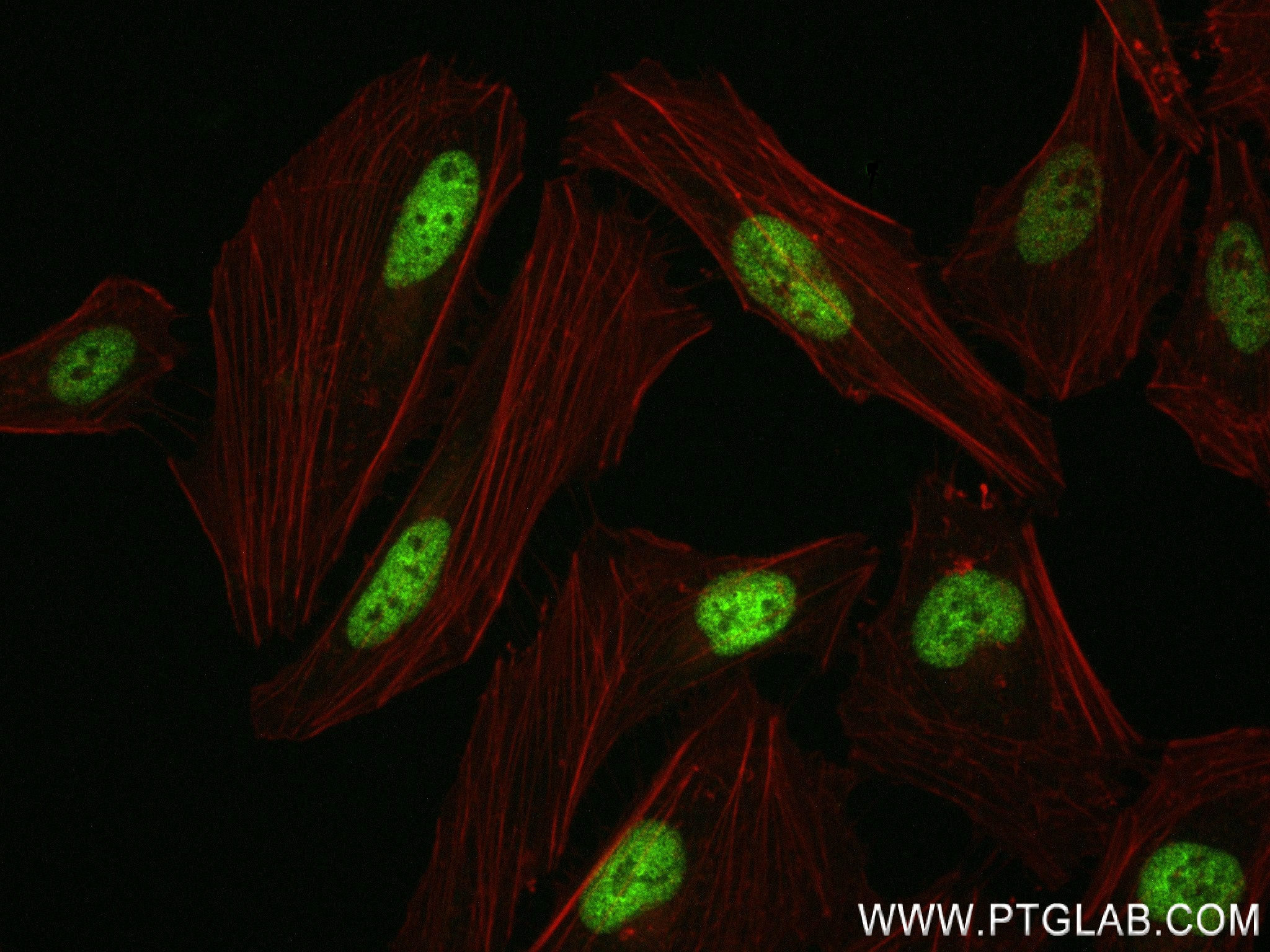 IF Staining of HeLa using 84747-1-RR IF Staining of HeLa using 84747-1-RR