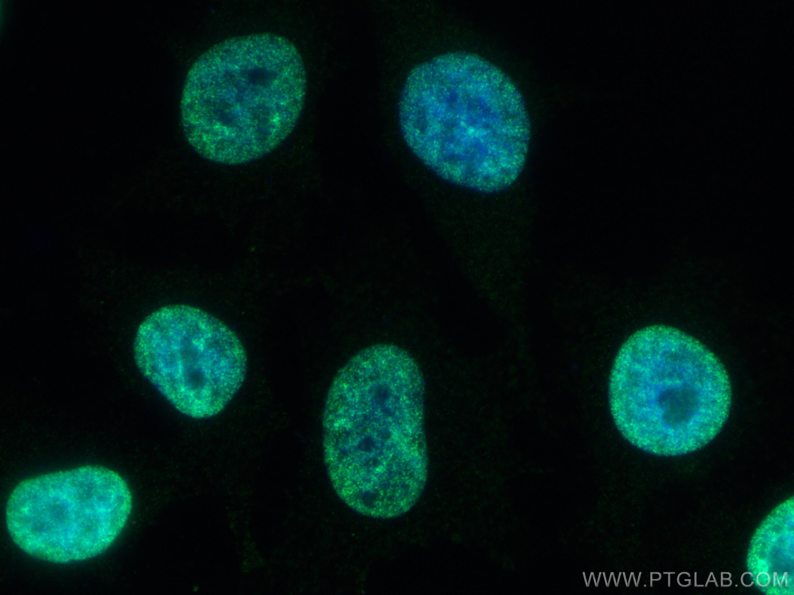 IF Staining of HeLa using 80219-1-RR (same clone as 80219-1-PBS)