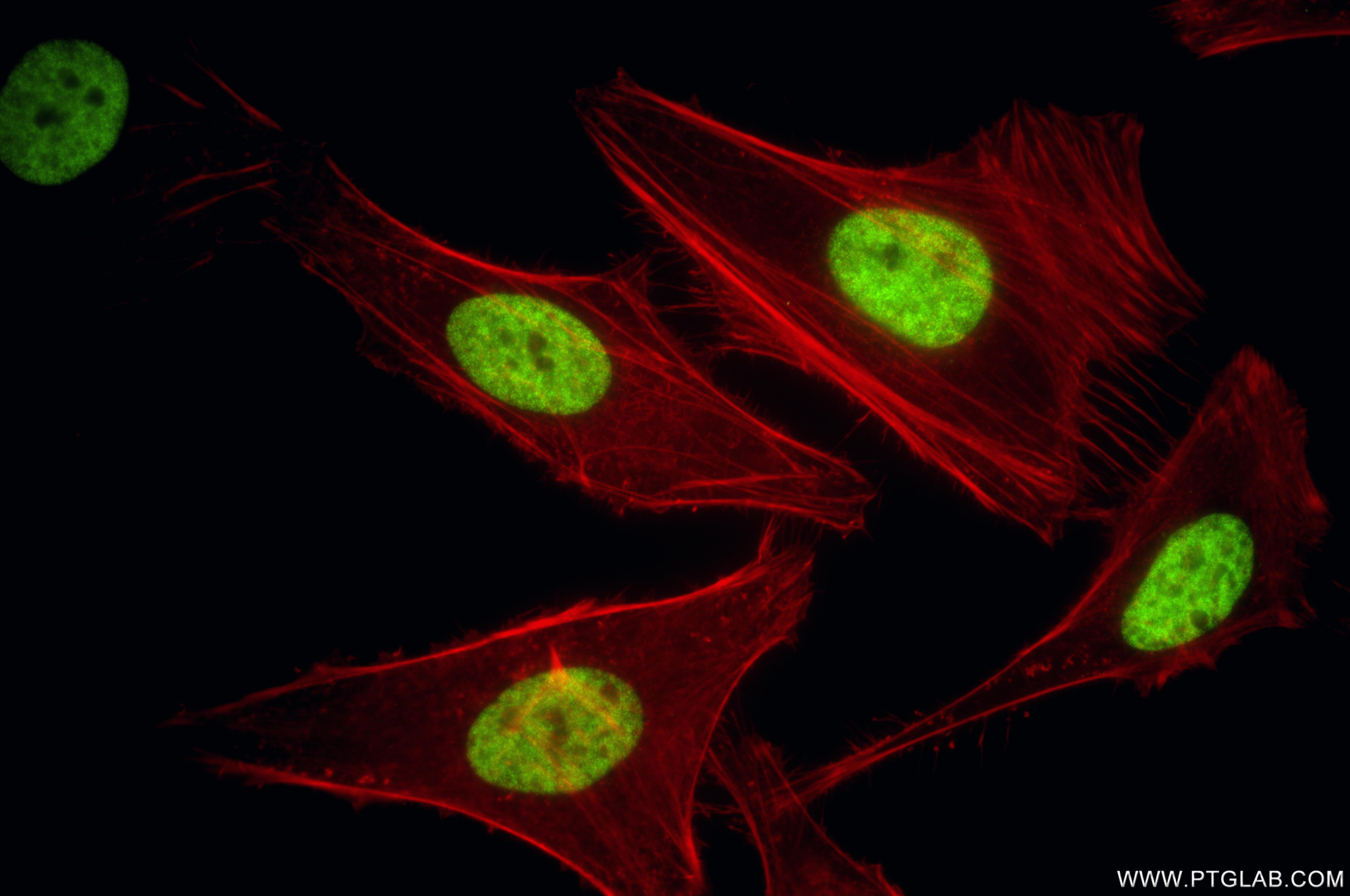 IF Staining of HeLa using 86990-1-RR (same clone as 86990-1-PBS) IF Staining of HeLa using 86990-1-RR (same clone as 86990-1-PBS)
