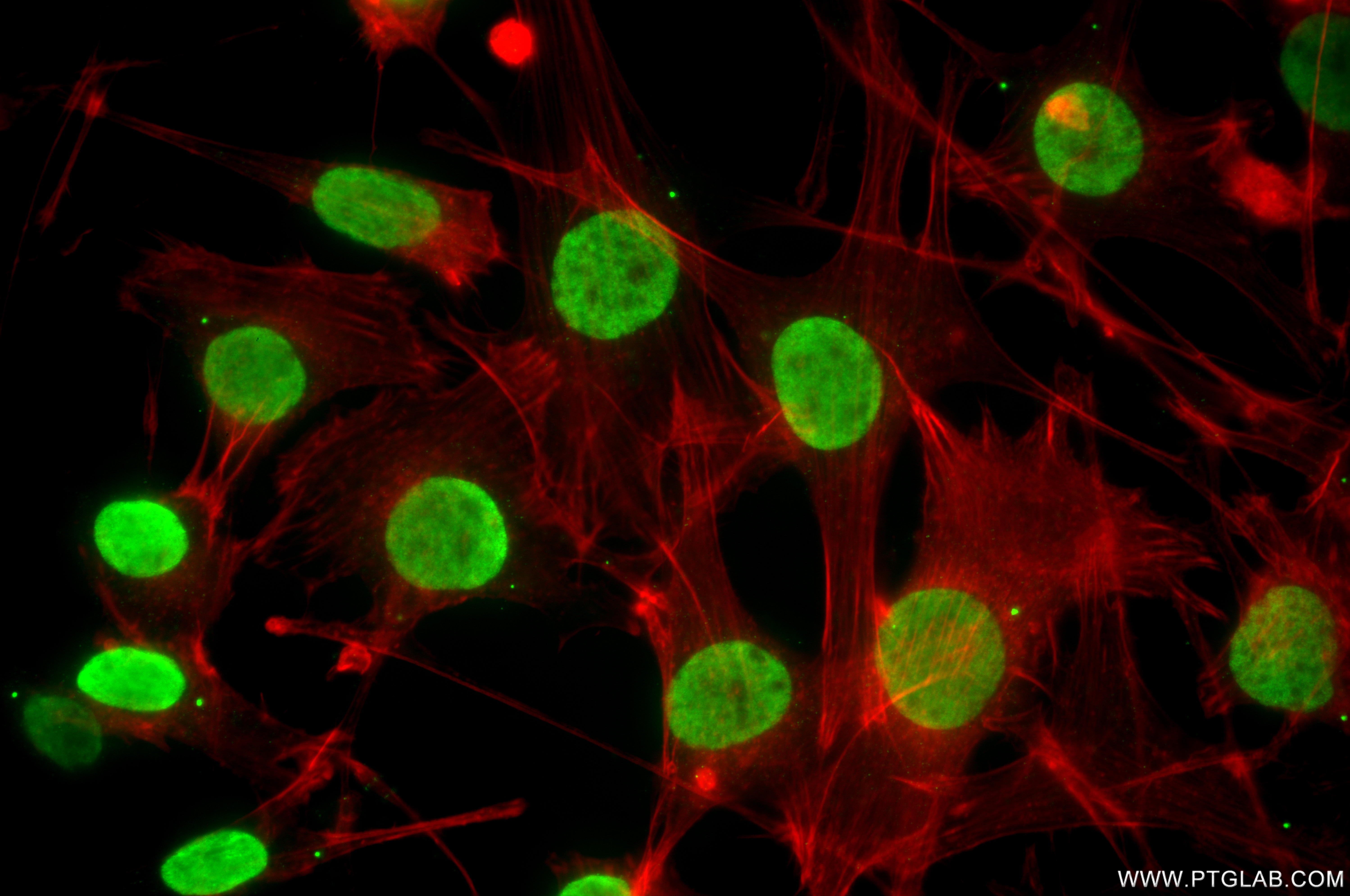IF Staining of NIH/3T3 using 86990-1-RR (same clone as 86990-1-PBS) IF Staining of NIH/3T3 using 86990-1-RR (same clone as 86990-1-PBS)