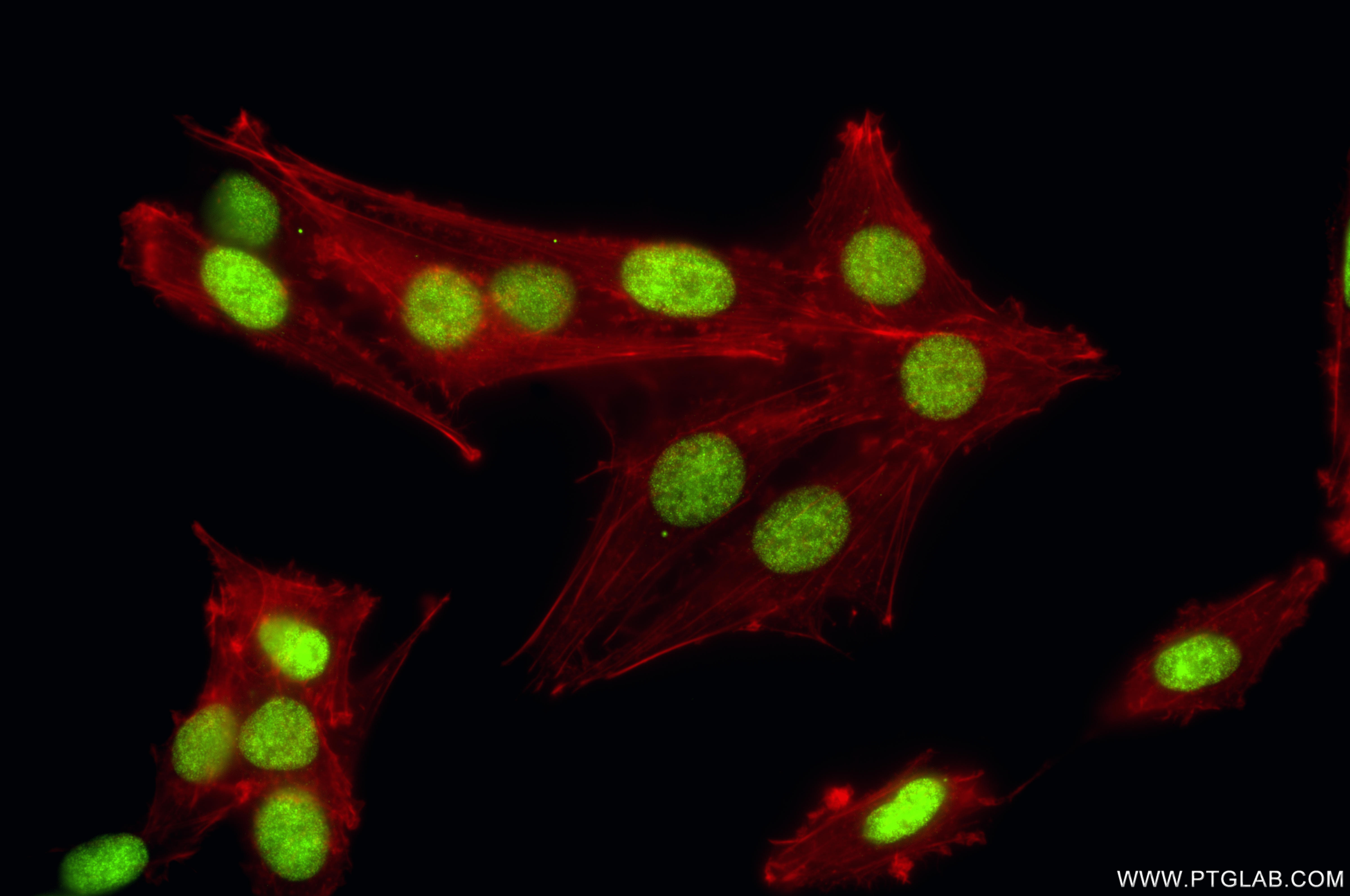 IF Staining of C6 using 86990-1-RR (same clone as 86990-1-PBS) IF Staining of C6 using 86990-1-RR (same clone as 86990-1-PBS)