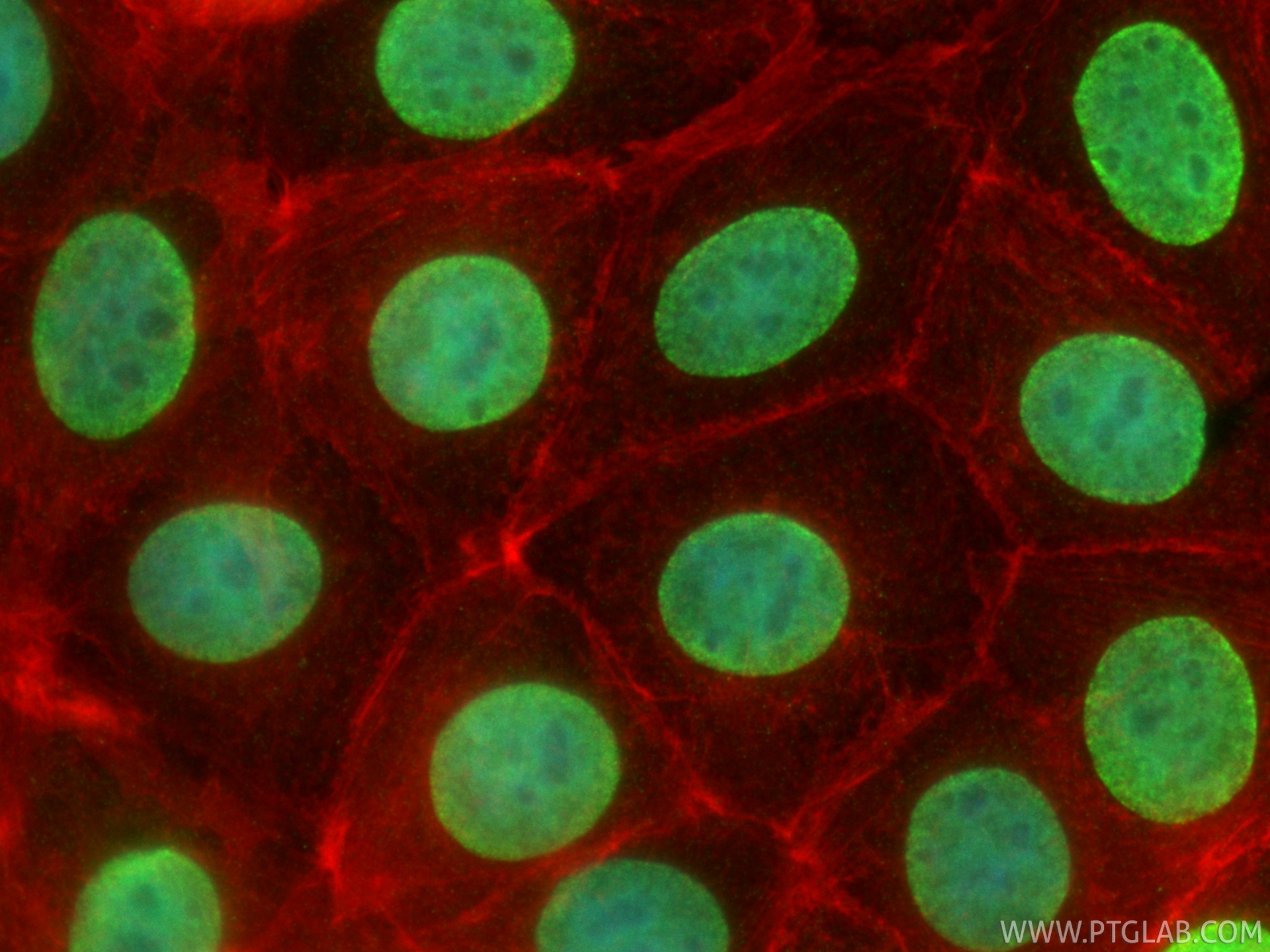 IF Staining of MCF-7 using 86990-1-RR (same clone as 86990-1-PBS)