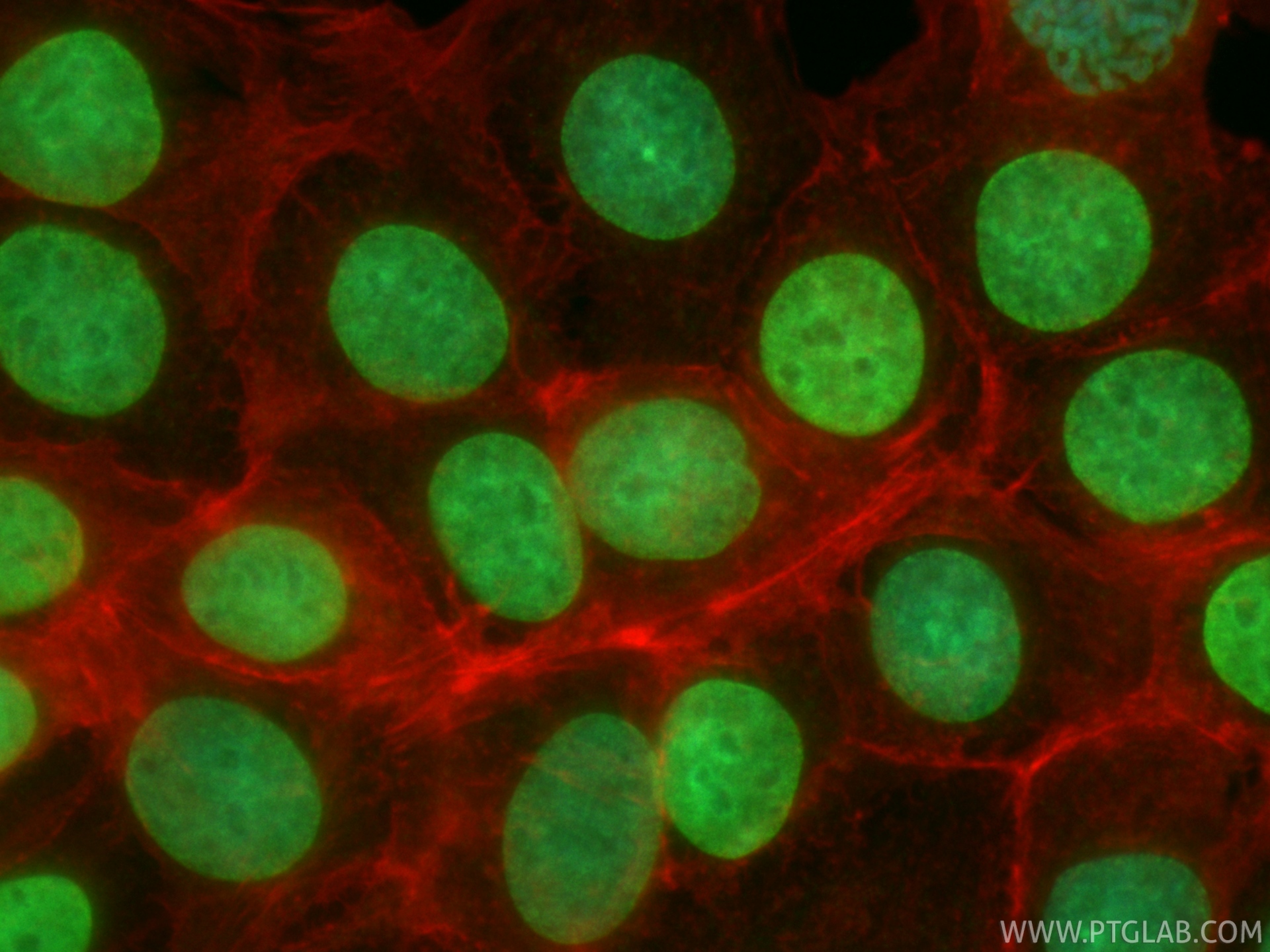 IF Staining of MCF-7 using CL488-86990