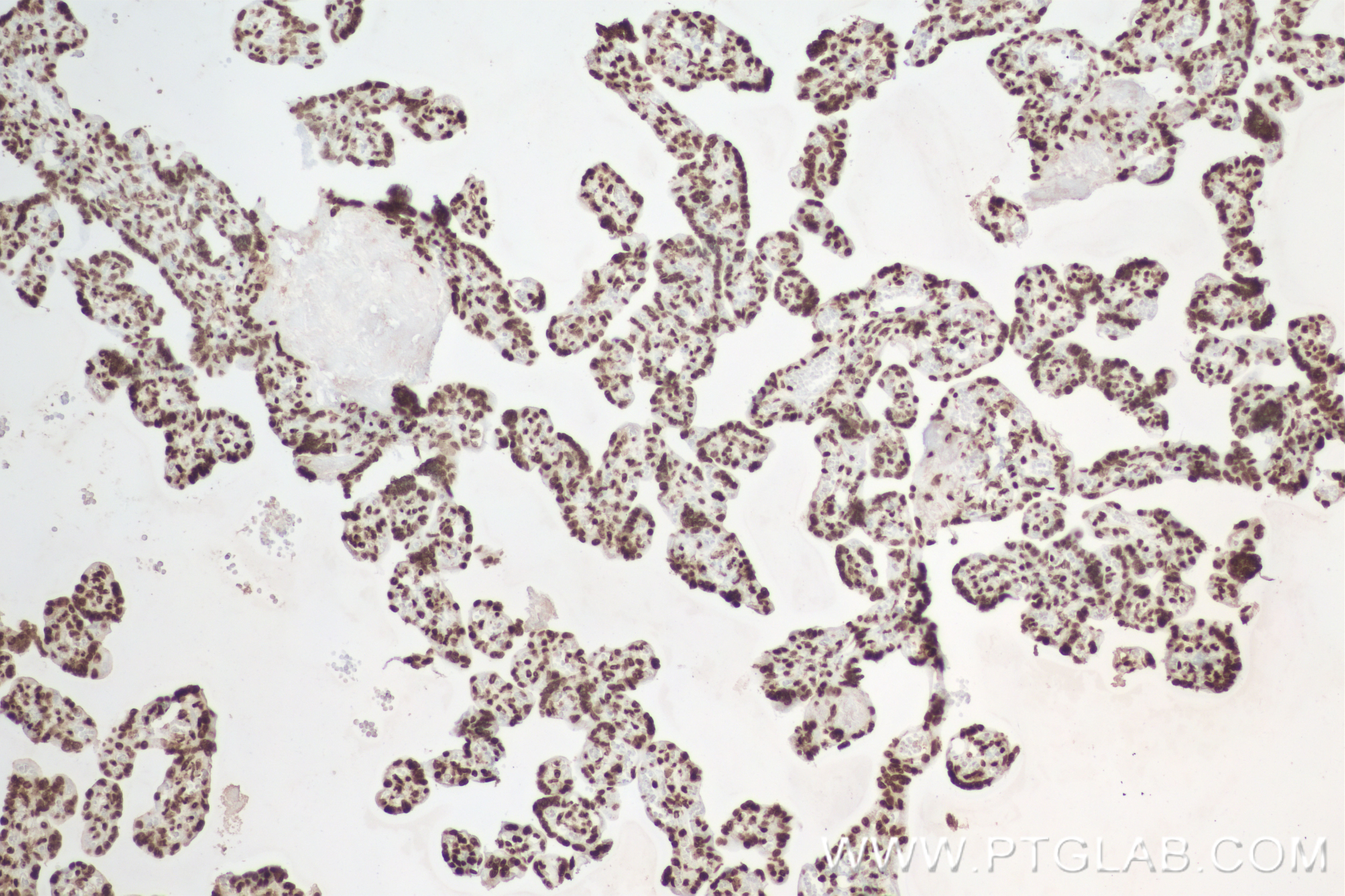 IHC staining of human placenta using 84908-1-RR