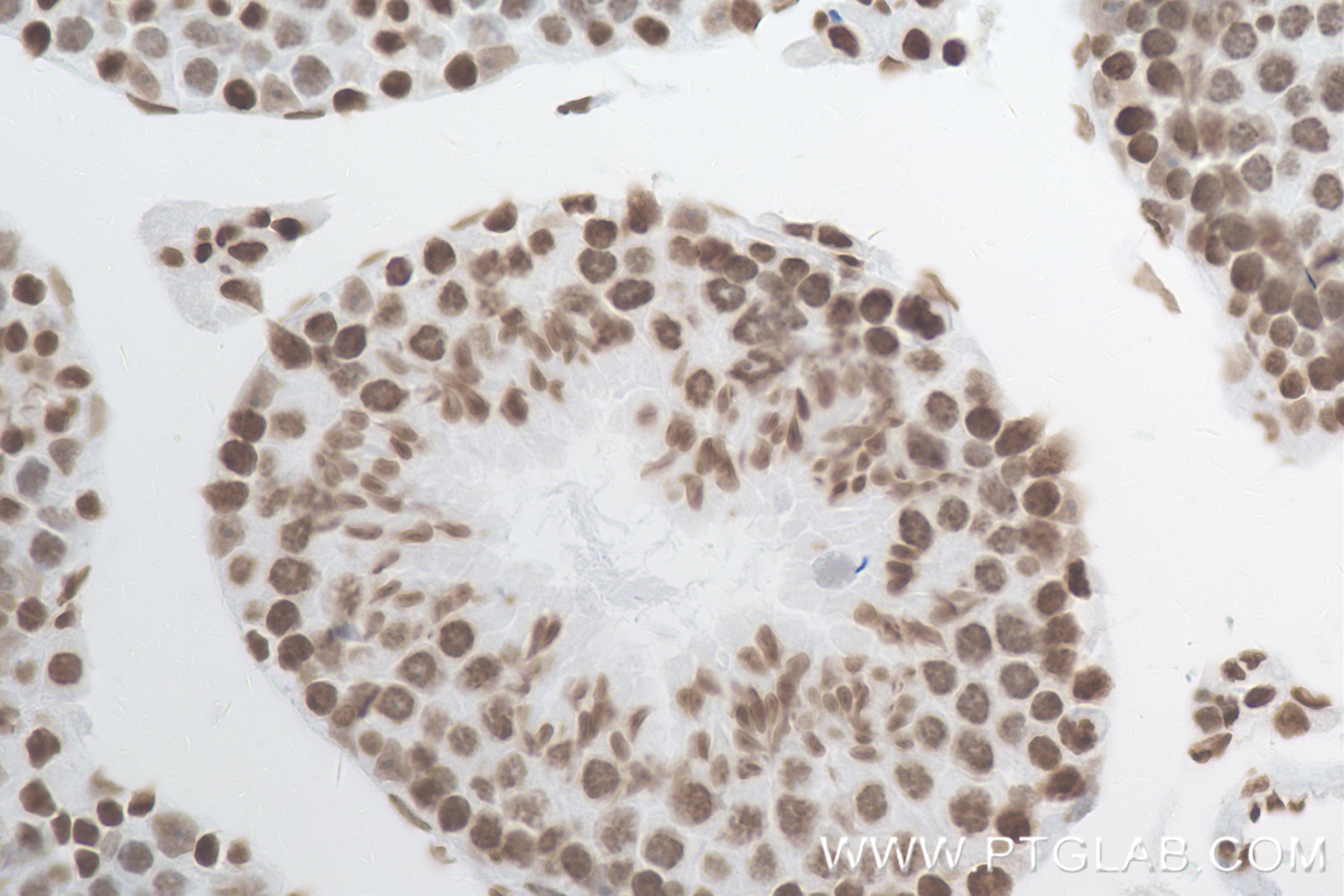 IHC staining of mouse testis using 84908-1-RR