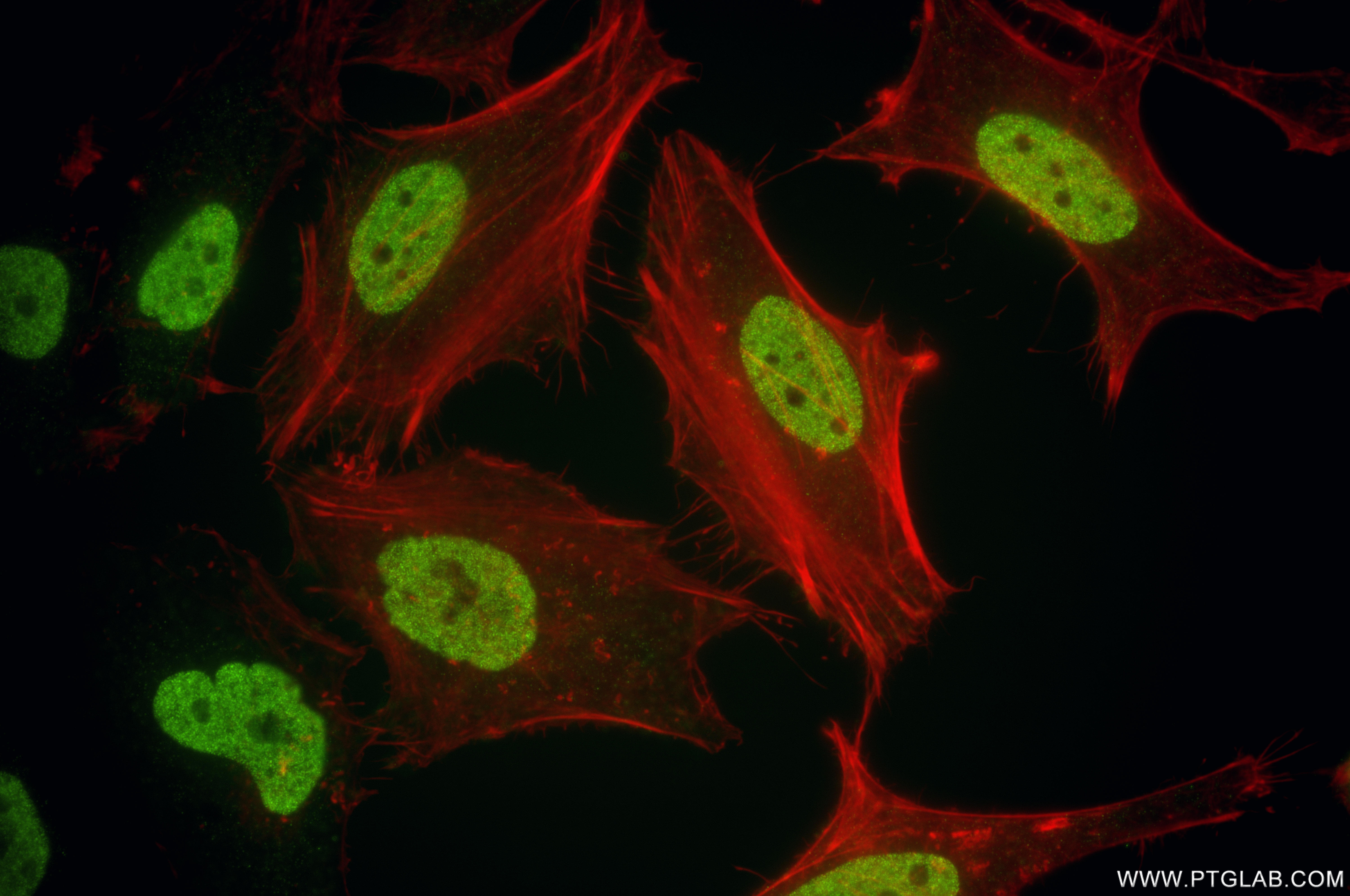 IF Staining of HeLa using 86861-1-RR (same clone as 86861-1-PBS)