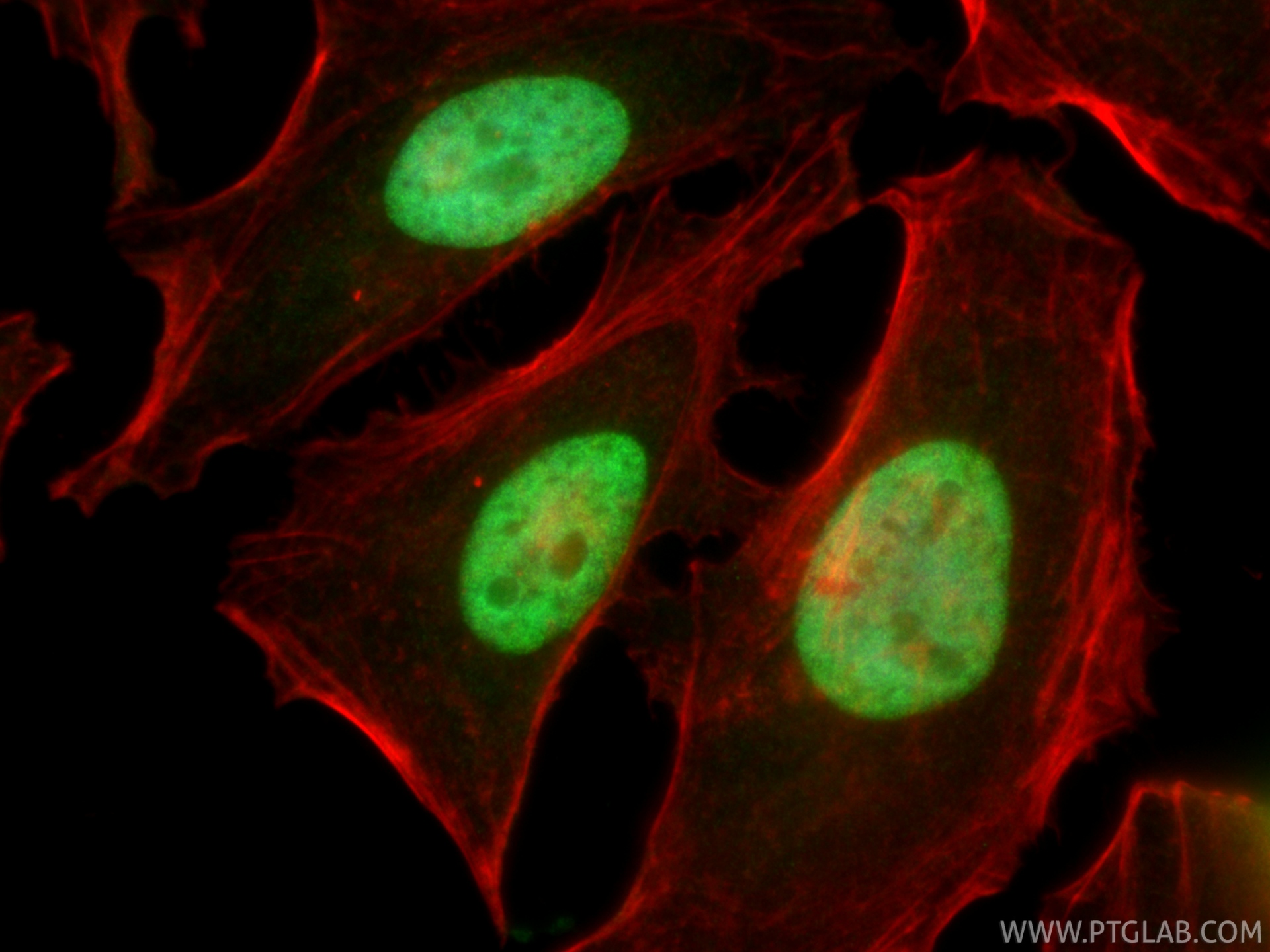 IF Staining of HeLa using 86861-1-RR IF Staining of HeLa using 86861-1-RR