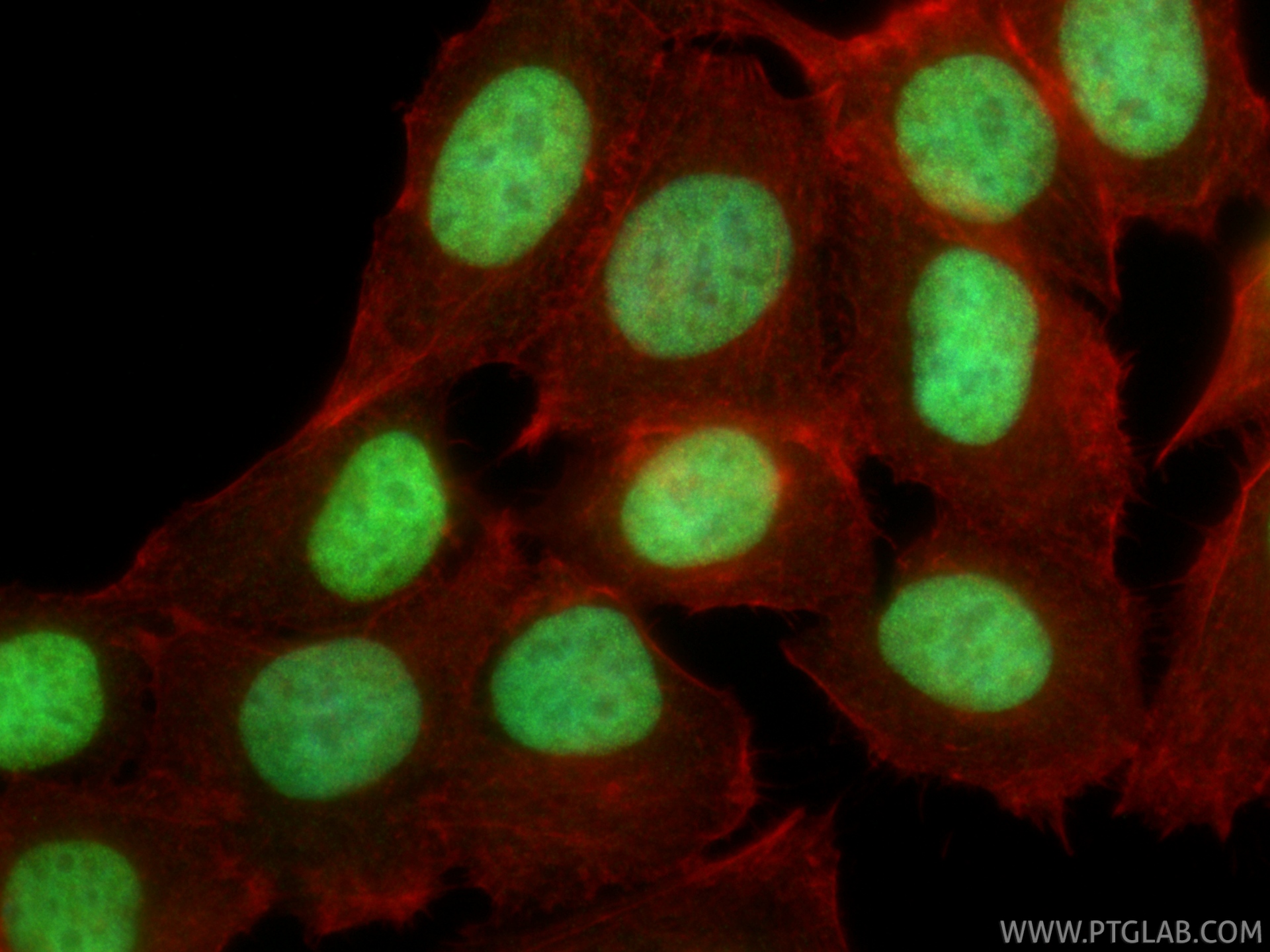 IF Staining of MCF-7 using 86861-1-RR IF Staining of MCF-7 using 86861-1-RR