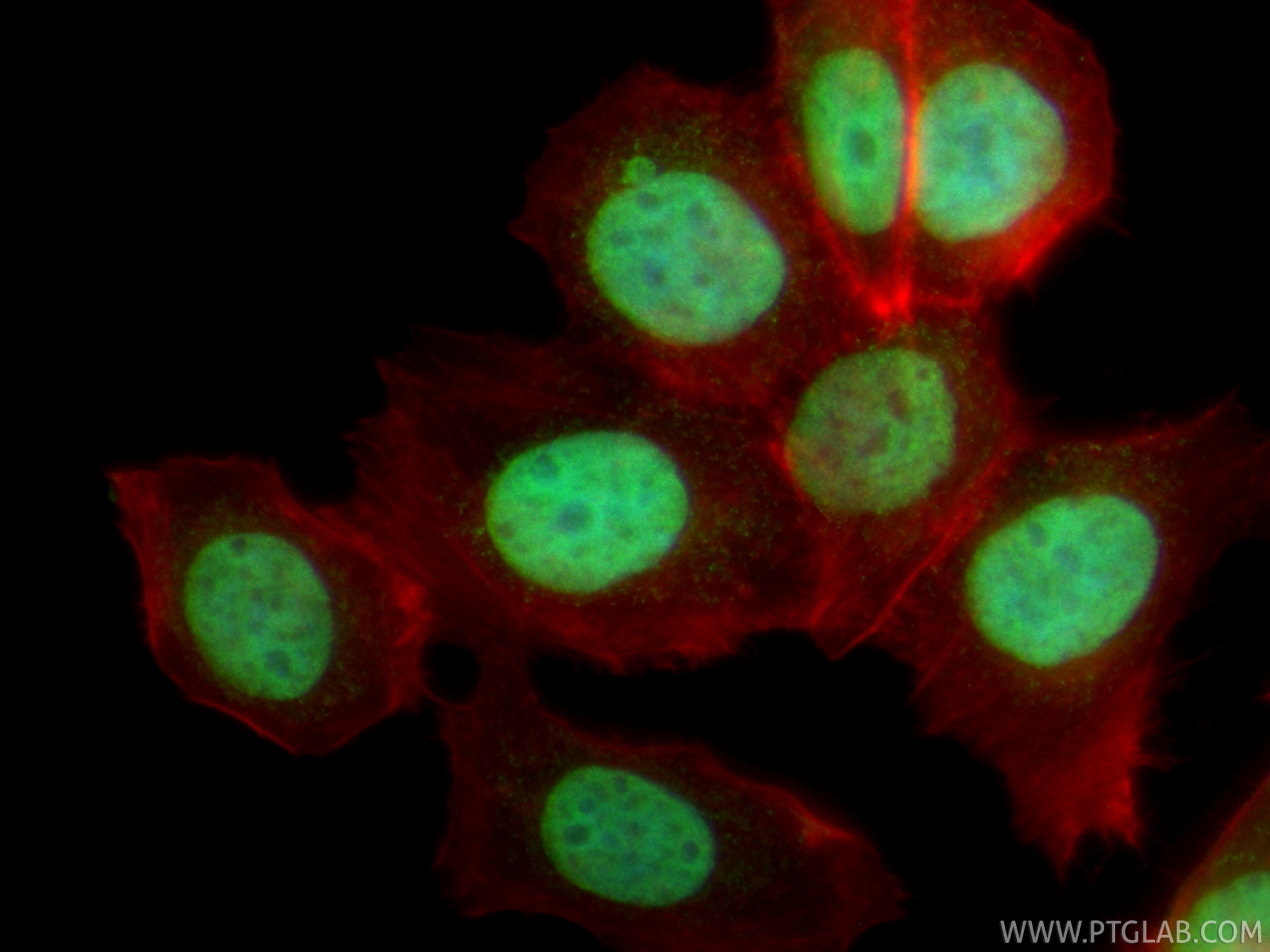 IF Staining of MCF-7 using CL488-86861 IF Staining of MCF-7 using CL488-86861
