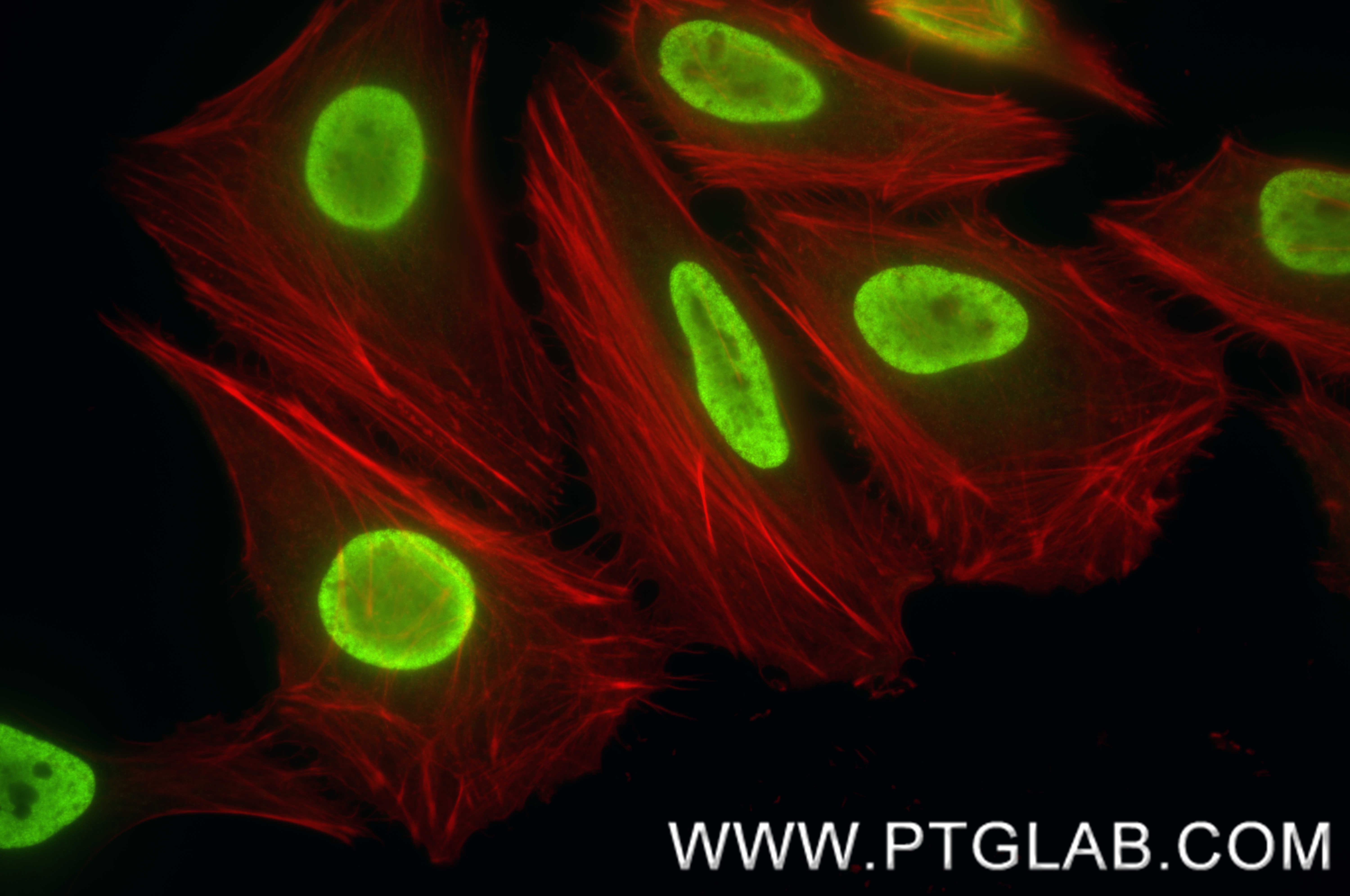 IF Staining of HeLa using 84740-1-RR