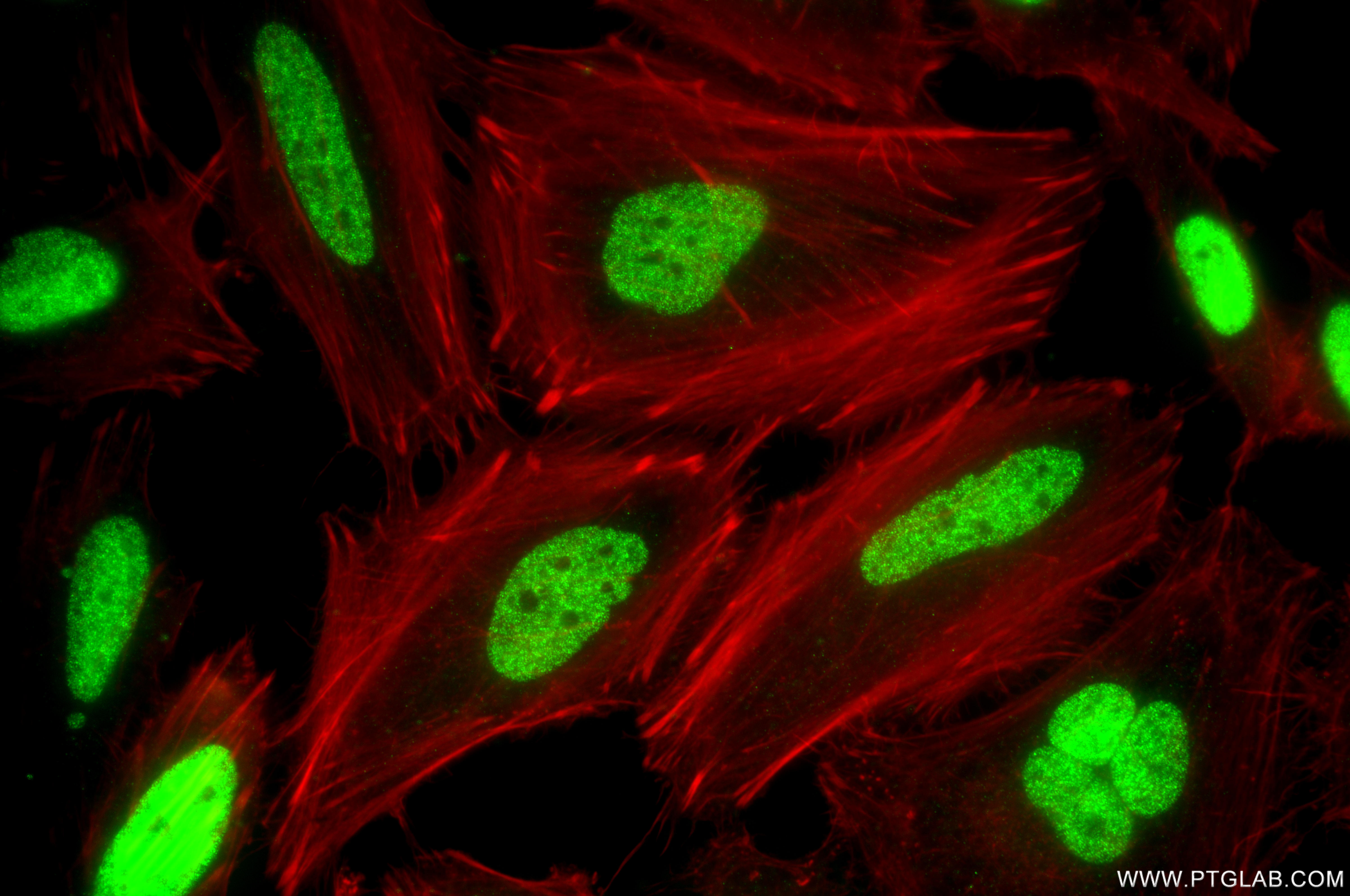 IF Staining of HeLa using 87727-1-RR