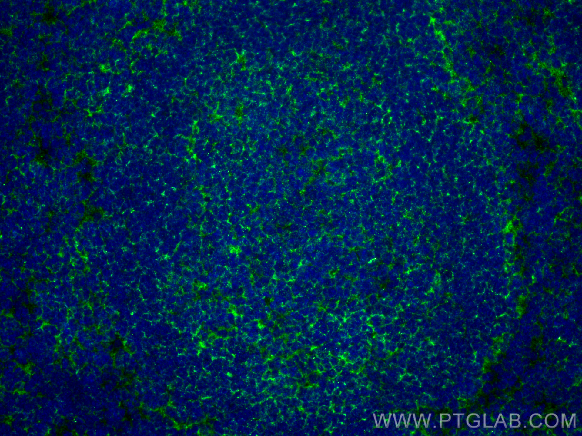 IF Staining of mouse spleen using 84325-1-RR