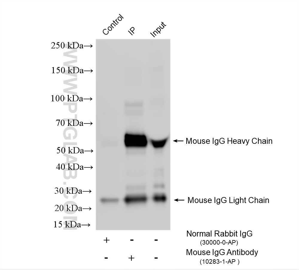 IP experiment of mouse serum using 10283-1-AP IP experiment of mouse serum using 10283-1-AP