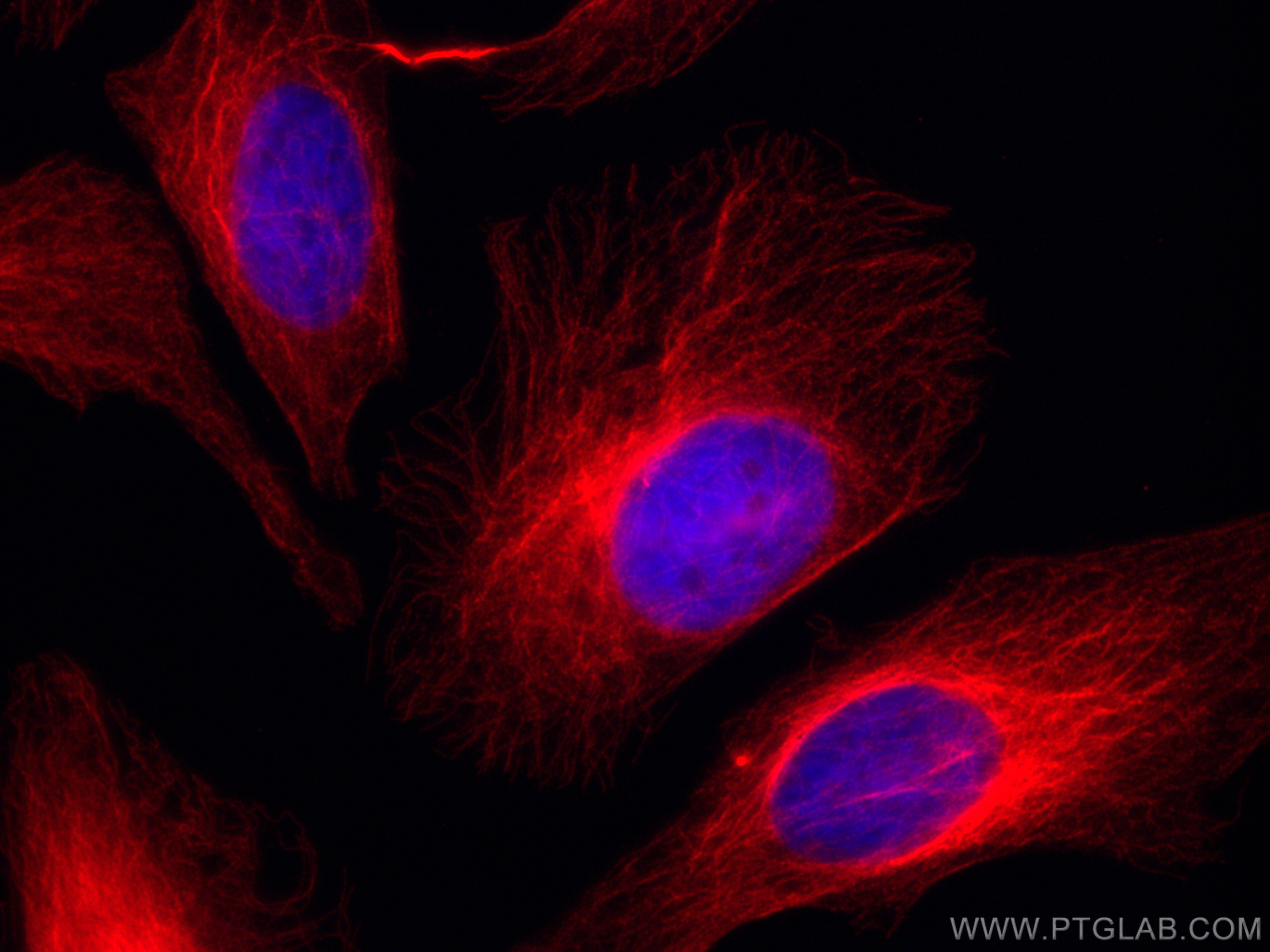 IF Staining of HeLa using CL594-10283