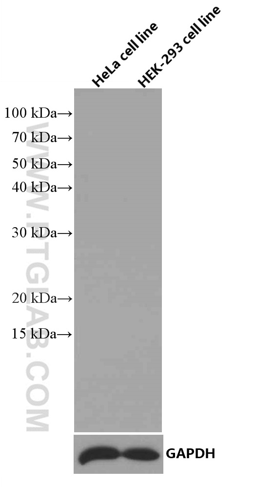 WB analysis using 66360-1-Ig