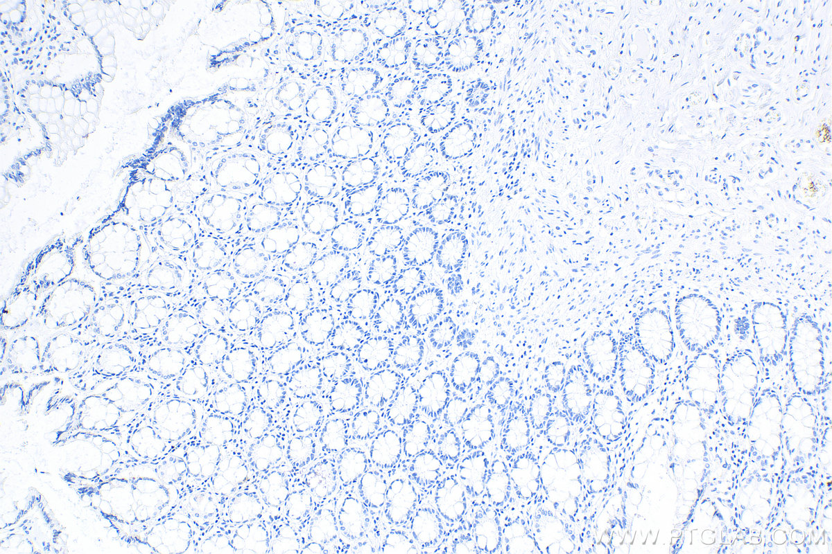 IHC staining of human colon using 66360-3-Ig (same clone as 66360-3-PBS)