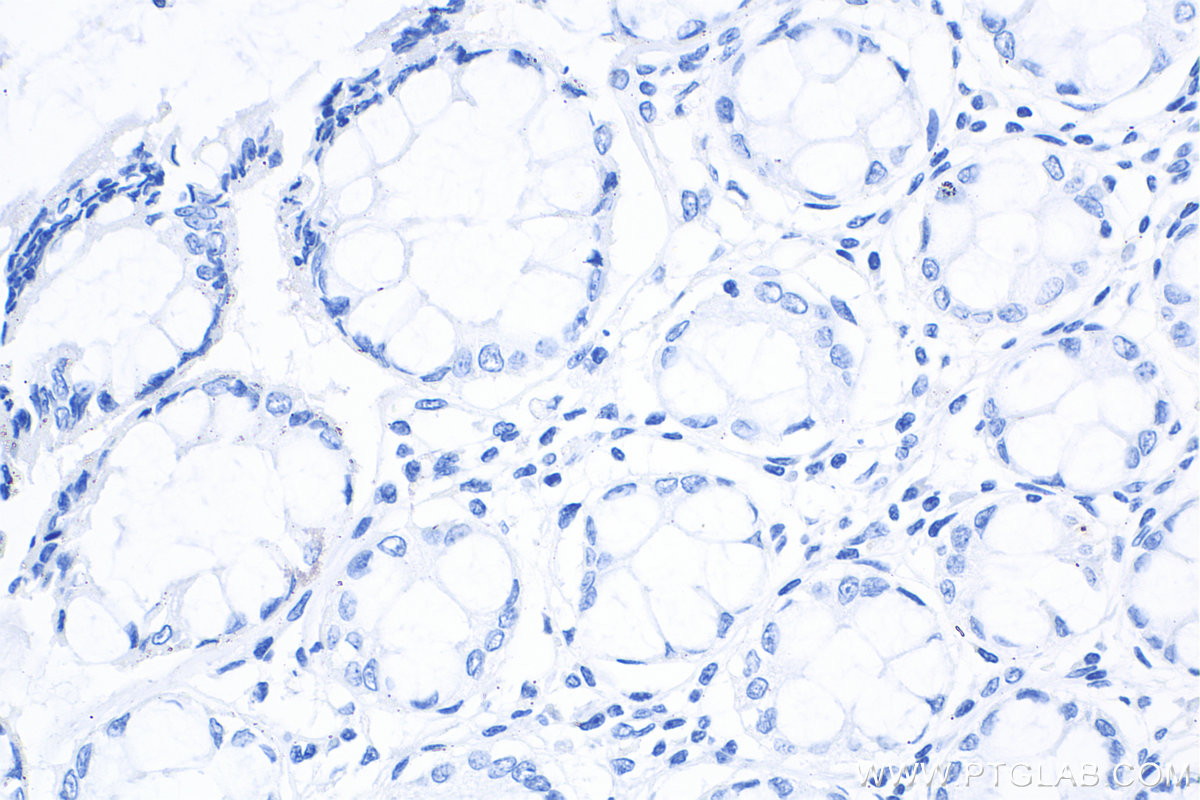 IHC staining of human colon using 66360-3-Ig (same clone as 66360-3-PBS)