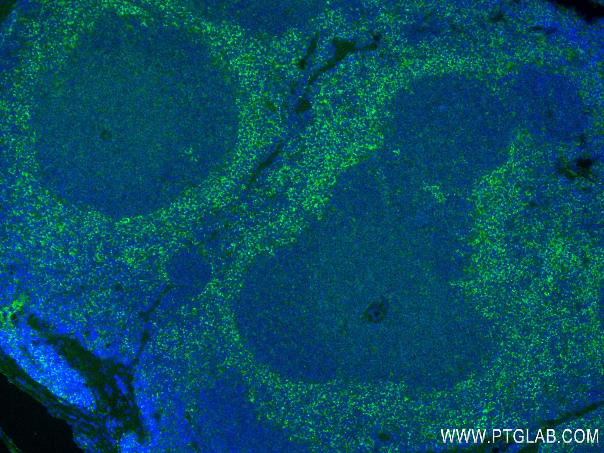 IF Staining of mouse spleen using 84436-4-RR