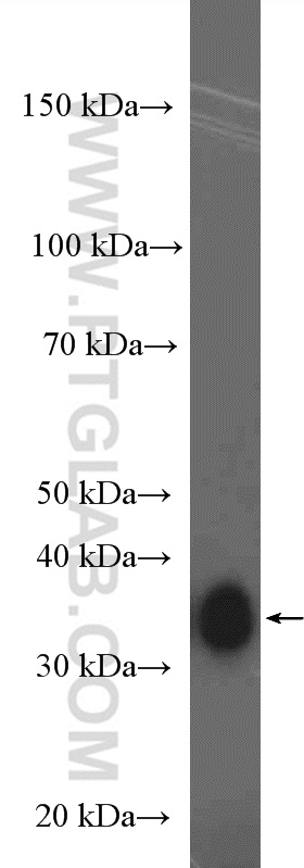 WB analysis of PC-12 using 10770-1-AP