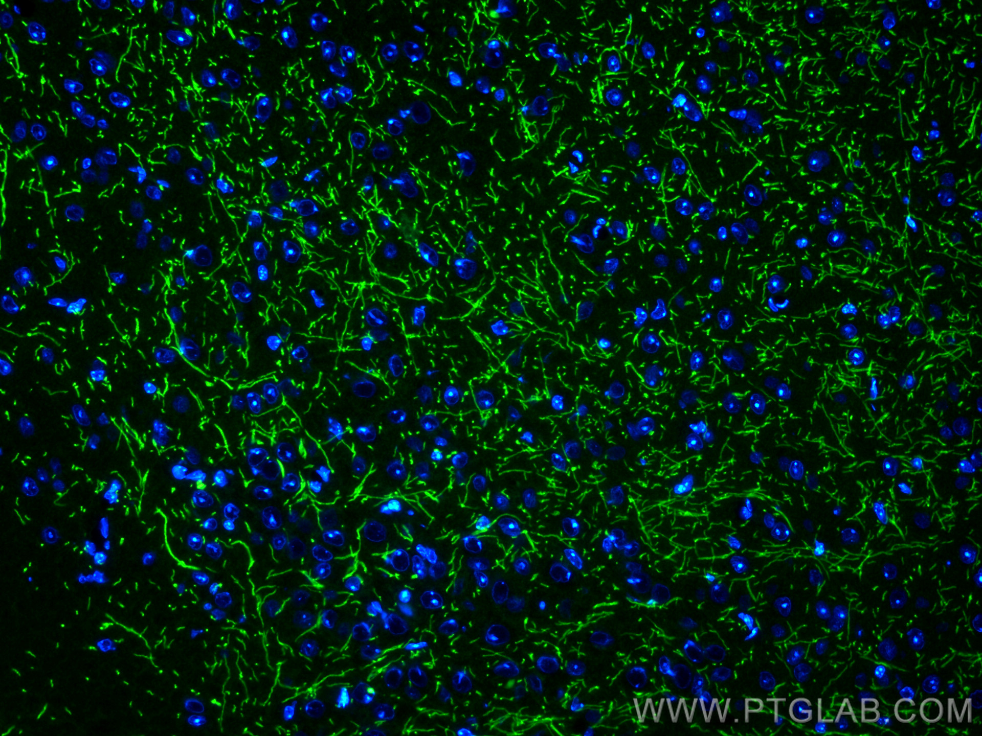 Myelin basic protein