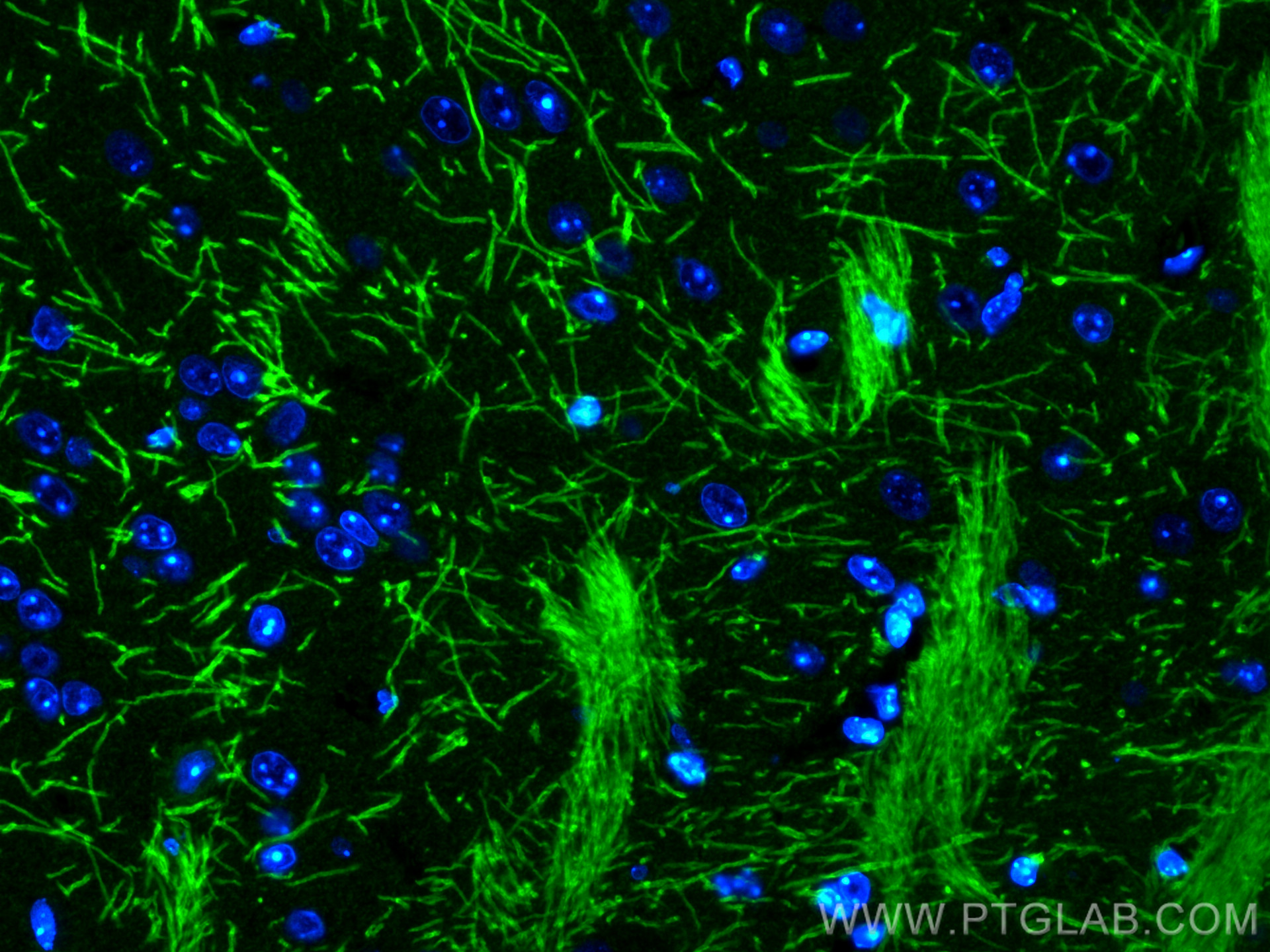 IF Staining of mouse brain using CL488-10458