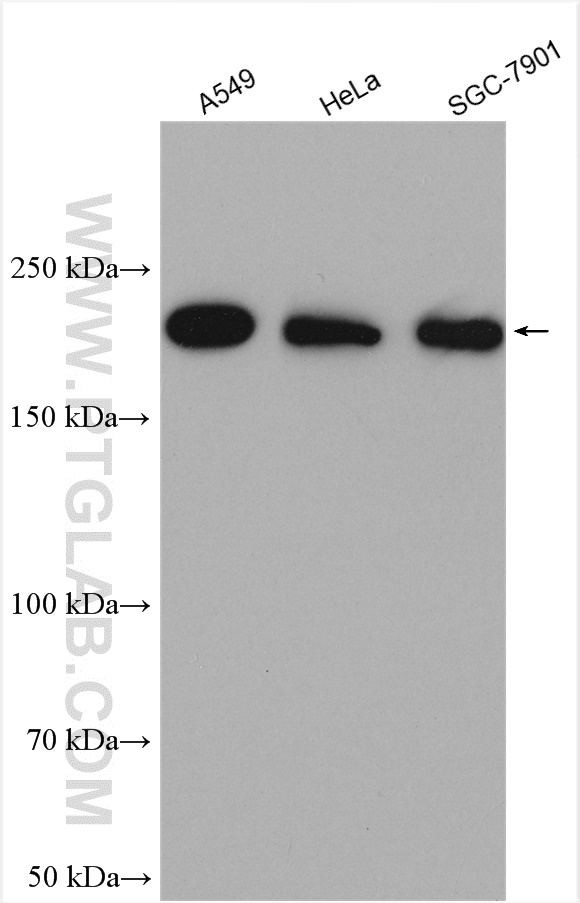 WB analysis using 14844-1-AP