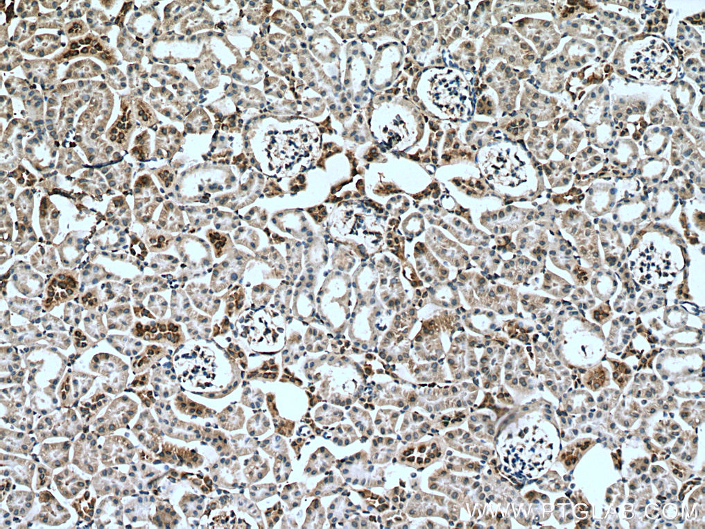 IHC staining of mouse kidney using 51053-1-Ig