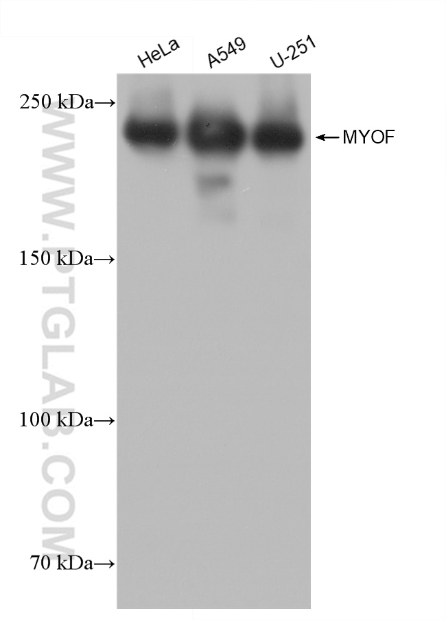 WB analysis using 82917-2-RR